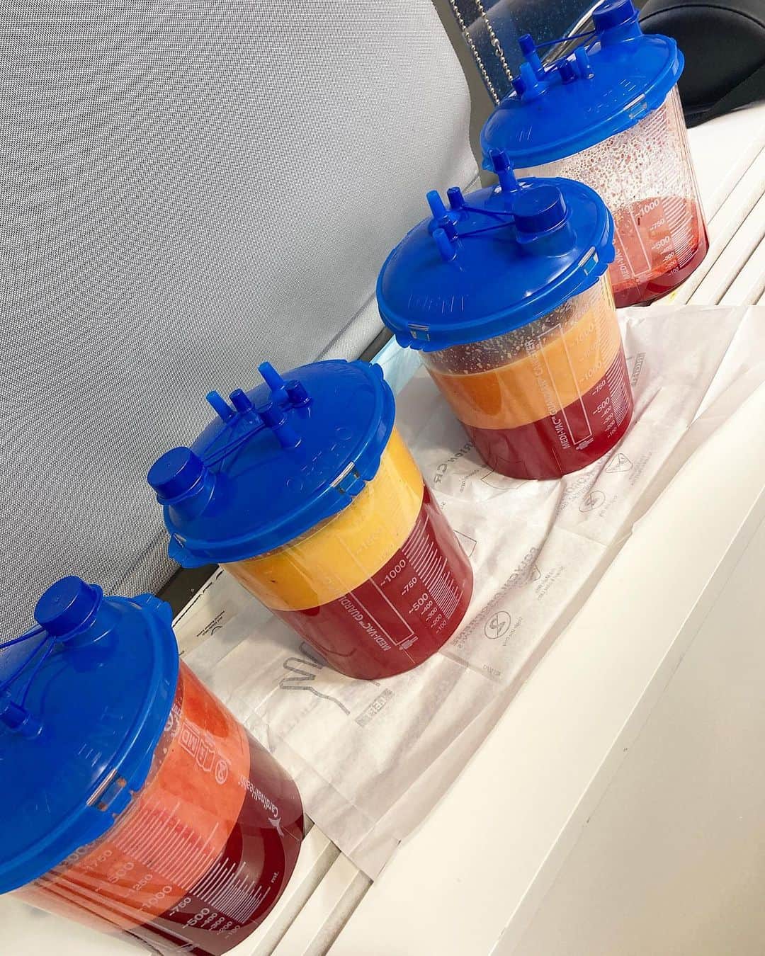 ファンクマスター・フレックスのインスタグラム：「This might be gross for some... this is what @elitebodysculpture removed from my stomach (lower,middle and upper) armpit area and back area (them handles)! 3 and 1/4 containers of fat (with alittle blood) @drtonyperkins appreciate u! As I continue to use those @40dayreset rules of clean eating! DOES THIS PIC TURN YOUR STOMACH?」