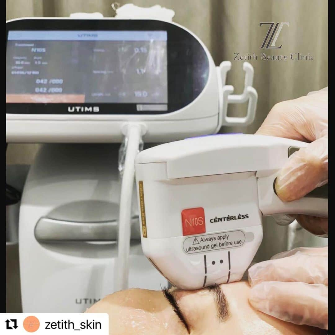 黒田愛美さんのインスタグラム写真 - (黒田愛美Instagram)「#Repost @zetith_skin with @make_repost ・・・ zetith_skin 皆さまこんにちは😃 Zetith Beauty Clinic大阪心斎橋院です🏥✨ いつもご覧いただきありがとうございます❣️  本日はご好評頂いている、大人気のキャンペーン✨✨HIFU✨✨  👉このような方へおすすめです😚 🌟シワを目立たなくしたい﻿ 🌟たるみを解消させたい﻿ 🌟ほうれい線、マリオネットラインが気になる﻿ 🌟目周りの小じわが気になる﻿ 🌟頬の毛穴が目立つ﻿ 🌟肌にハリがなくなってきた﻿ 🌟フェイスライン、二重顎が気になる﻿ ﻿ 当院では、✨最先端たるみ治療HIFU✨を行っております💕肌の土台からアップし、重力に負けない弾力のあるお肌を作ることができます😊👍﻿ ﻿ ﻿ 従来のHIFUは、、、﻿ 皮膚表面に過剰な熱を受けやすく、施術中の痛みが苦痛であったり、火傷のリスクが伴いやすかったのですが…😣⚡️﻿ ﻿ ﻿ 当院が取り扱っている✨UTIMS A3✨は﻿ センターレスHIFUが搭載されているため、皮膚表面が受ける過剰な熱負担を軽減してくれます💓そのため、痛みや火傷のリスクがほとんどありません☺️✨﻿ ﻿ ﻿ さらに…‼️✨﻿ ３つのカートリッジを使用することで﻿ たるみの原因となる皮膚の各層に、それぞれアプローチしてくれます😆💕﻿ ﻿ 糸リフトなどに抵抗がある方や 周囲の方にバレたくない方でも お気軽にお試し頂けます♥️﻿ ﻿  ⏰施術時間 約45〜60分 🍎赤み 軽度の赤みや腫れを生じますが、2日程度で消失します ※身体の温めすぎにご注意ください。 熱が顔にこもり腫脹が出やすくなります。  ⚡️痛み 場所により熱感や鈍痛を感じます 💄メイク 当日より可 🛁入浴／シャワー 当日より可 🌈効果 1ヶ月半〜2ヶ月で実感していただけます  直後からでも、口角が上がる❣️ 目が開きやすい❣️フェイスラインがすっきりした気がする❣️とたくさんのお声をいただいております✨  皆さまのご来院心よりお待ちしております😊❣️  ⭐️銀座院⭐️ 東京都中央区銀座4丁目2－17 銀座111レジャービル13階 📞03‑6271‑0977  ⭐️大阪院⭐️ 大阪府大阪市中央区西心斎橋1-10-40サンメゾン心斎橋セレブリテ２階 📞06-4256-3338  #ゼティスビューティークリニック#zetithbeautyclinic #美白ケア #毛穴ケア#たるみケア #整形 #美容整形 #プチ整形 #美容皮膚科 #美容皮膚科大阪 #美容外科 #美容外科大阪 #ミナミ #大阪 #心斎橋  #うる肌　#ツヤ肌　#美魔女　#たるみ大阪　#ハイフ安い　#大阪美容外科　#鼻整形　#ハイドラ　#糸リフト大阪 #zetithbeauty#ゼティスビューティークリニック大阪心斎橋院 #ゼオスキン #ハイフ #たるみ改善 #ハイフ安い」12月2日 10時50分 - kurodaaimi