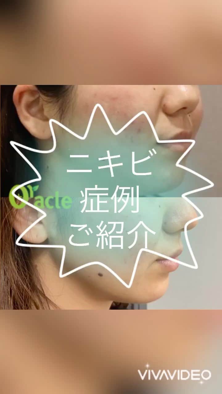 オラクル美容皮膚科東京新宿院のインスタグラム
