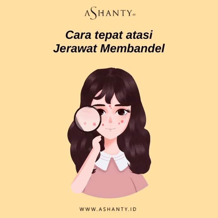 ASHANTY BEAUTY CREAM OFFICIALのインスタグラム：「Jerawat membandel membuat kita menjadi kurang percaya diri, sudah mencoba berbagai cara untuk mengusir jerawat namun jerawat tak kunjung hilang ?   Ladies tidak perlu cemas, atasi jerawat membandel pada pada wajah dengan cara yang tepat! • Rajin membersihkan wajah 2 kali sehari dan jangan lupa lakukan double cleansing yaa  • Istirahat cukup, tidur teratur dan hindari begadang. • Perbanyak konsumsi air putih, buah dan sayur. Lakukan juga olahraga ringan yaaa • Gunakan cream perawatan wajah yang tepat seperti Acne Cream Series by Ashanty yang akan merawat dan menutrisi kulit wajah secara maksimal 🌸  _________________________________ Informasi dan pemesanan : WA: 081293823950 WA: 085781140354 WA: 081287388885 WA: 087778489900 FAST RESPONS CLICK LINK yang ada di Bio IG @ashantyid  _________________________________ #ashantybeautycosmetics #beauty #cosmetics #brandlocal #kosmetikhalal #makeup #kosmetikartis #ashanty #thehermansyah #beautyvlogger #jualkosmetikmurah #kosmetikmahal #kosmetikbagus #ashantyid #keluargaasix #ashantyhermansyah #mua」