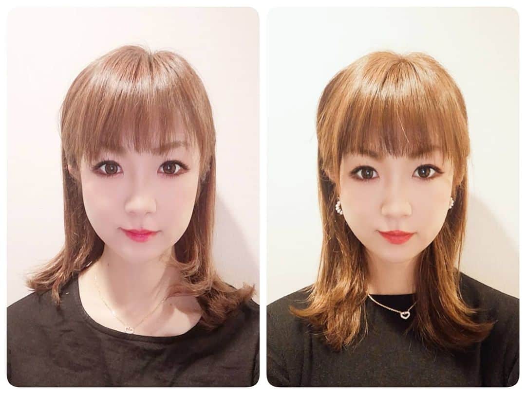 中島彩のインスタグラム：「ハイフ３回目レポ💕　 左は２回目直後、右は３回目直後のお写真✨　 効果の持続力がでてきたようですが😍やっぱり並べて比べると変化を実感💕 ハイフを始めてから気になるフェイスラインがすっきりで嬉しい😍むくみにくくもなりました😘 実は絶賛リバウンド中なのですが、周りにもばれていないようです😝💦絶対ハイフのおかげ😝 @maison_de_m_misa 通いだしたお友達たちも絶賛してくれてます😍 私も年内もう一度行きたいなぁ...❤️ 施術後いただけるドリンクが酵素ドリンクで感激～😍最後まで美意識高まる😏💕 サロンがクリスマス仕様で可愛かったなぁ❤️  #ハイフ　#アンチエイジング　#エイジングケア #ビフォアフ　#ハイフエステ #ビフォアフ写真 #ビフォーアフター　#エステサロン　#阪急塚口」