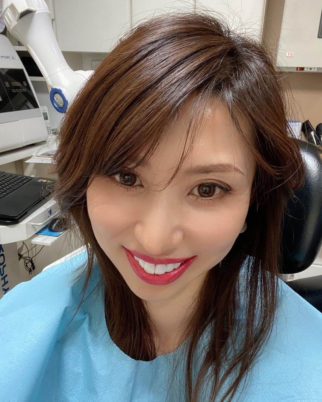 sachi♡さんのインスタグラム写真 - (sachi♡Instagram)「♡_  楽しみにしていた2回目の カラサワ歯科クリニック @shinjuku_karasawa_dc に お邪魔して来たよ🦷  今回は歯を削らずにジルコニアの歯を装着する治療法 「スマートラミネート」の トライフィッティングをして貰いました。  白く整った歯はやっぱり美しくて 笑顔に自信が持てるよね♡  実際の治療を始める前に完成形を確認出来ると 治療に踏み出しやすいし安心して治療に臨めます。  カラサワ歯科クリニックでは治療前の段階で シミュレーションを元に最適な治療選択や治療計画を じっくり丁寧に相談に乗ってくれます。  お値段も良心的なので矯正をお考えの方は とってもおすすめです♡  新宿駅西口から徒歩2分でアクセスも良く 個室もあるから安心して相談出来ますよ♬  #カラサワ歯科クリニック #矯正歯科 #審美歯科 #新宿歯科 #新宿 #歯科 #スマートラミネート #ラミネートベニア#削らないラミネートベニア #美容歯科 #矯正女子 #美容 #エイジングケア #アンチエイジング #アラフィフ #アラフィフママ #jマダムのおしゃれ #大人女子 #美魔女 #美容モデル #ミセスモデル #読者モデル #ミセス日本グランプリファイナリスト #美容好きな人と繋がりたい #ponte_beauty #ママ美容」12月4日 20時35分 - nail_salon_felice04