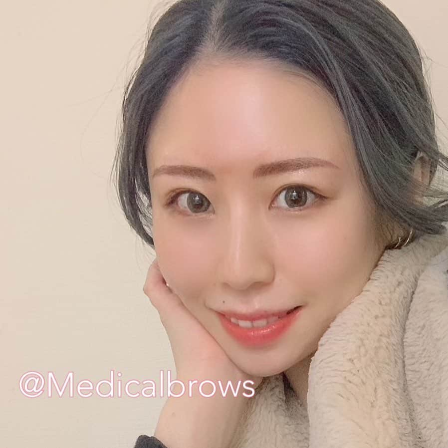 横井美穂さんのインスタグラム写真 - (横井美穂Instagram)「ストーリーに眉アートの事書いたら 反響あったので写真載っけるね🦋  以前から気になってた @medicalbrows さんに行ってきました🌟  最新技術とされてる 6Dストロークってゆうすべて手彫りでプロのアートメイクアーティストさんが1本1本丁寧に顔の黄金比にあった眉を描いていくってゆうものなんだけど、 終わって本当びっくりした。 すっっっごい自然でどの角度から見ても 完璧な眉でかなり感動しました🥺✨✨  2回に分けて眉をいれていくのだけど 1回目でこんな綺麗に仕上がった！！ でもまた1.2ヶ月に最後の仕上げは ちゃんと行くんだけどね笑  この写真は今日眉アートしたばっかだから まだ色がはっきりしてるけど これから段々薄くなって馴染んでくるから それが楽しみ😘💓  仕上がりに大満足です❤️ 雰囲気ほんと変わる！ @medicalbrows 本当におすすめします！！ 女の子もちろん男性の方も🙋‍♂️  #medicalbrows  #メディカルブロー  #メディカルアートメイク  #アートメイク #美容#美眉#artmake」12月5日 0時47分 - miho__yokoi