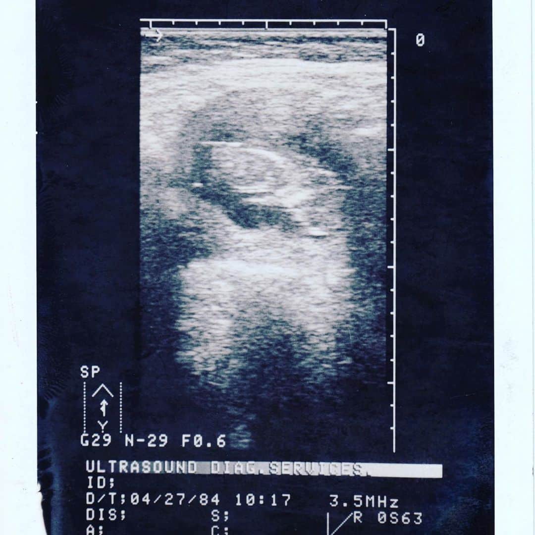 ケリー・オズボーンのインスタグラム：「#FBF this is the first picture ever taken of me. If you look closely you can see my little tiny  hand throwing Metal horns!!! 🤘」