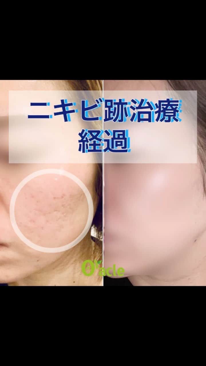 オラクル美容皮膚科東京新宿院のインスタグラム