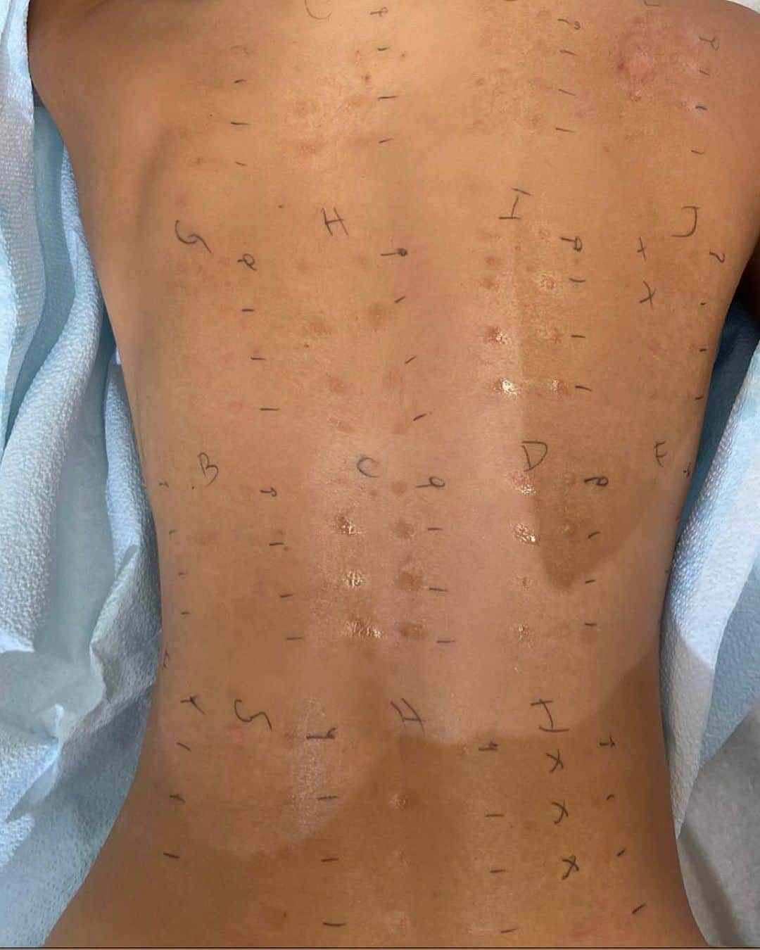 Just Jaredさんのインスタグラム写真 - (Just JaredInstagram)「Eiza Gonzalez took an allergy test and it revealed that she’s allergic to dozens of things. Tap this photo at the LINK IN BIO for the full list and more on her lifelong struggle with allergies. #EizaGonzalez #Allergies Photos: Getty, Instagram」12月5日 12時10分 - justjared