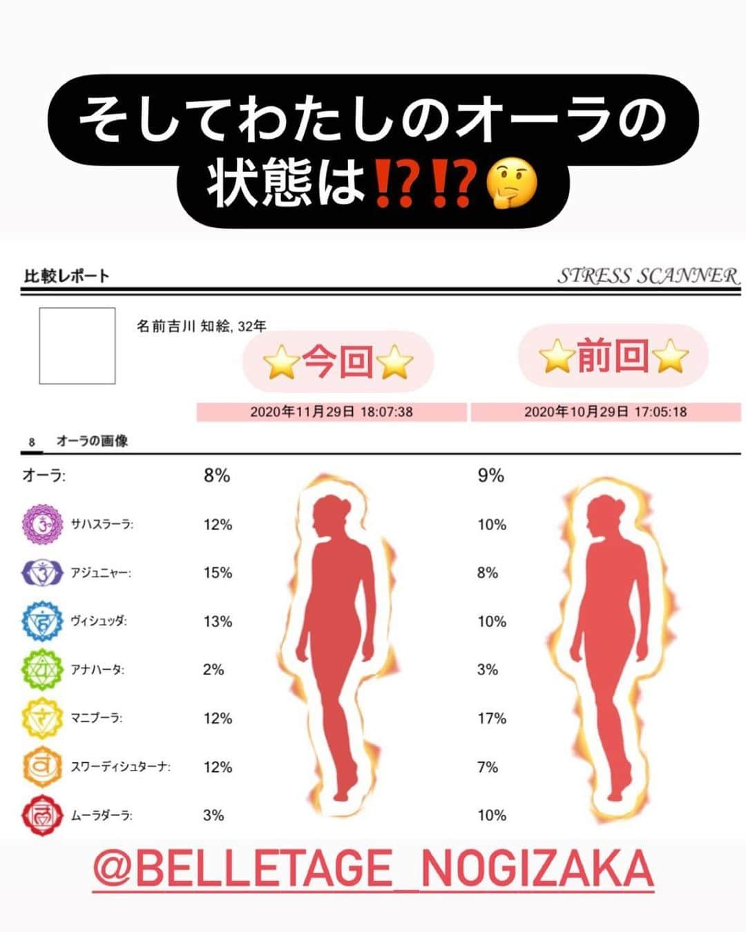 吉川ちえさんのインスタグラム写真 - (吉川ちえInstagram)「こんばんは🥺❤️ . この前脳リラ🧠しに乃木坂にある @belletage_nogizaka に行ったよ🦄 . 今回２回目の施術です🙋‍♀️💕 心と身体をチェックする計測器(都内はここだけしかない✨) で測ったらやっぱり大きなオペ🏥の前なのか ストレス度数が上がってました🥶🤲w . 本当に凄いなぁ🥺‼️ ストレスを緩和させる為に 脳リラフェイシャル受けました🧚✨ ２回やって２回とも爆睡😪笑 . 終わったあとは肌つるつるだし 夜はぐっすり眠れました🐣❣️ . #cbd #cbd自律神経調律フェイシャル」12月6日 17時13分 - yoshikawachie_16