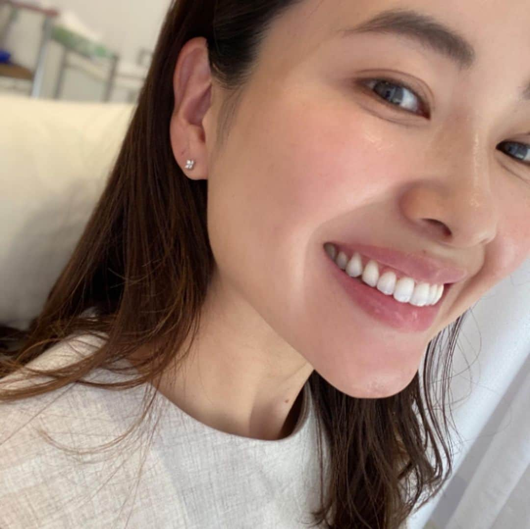 IIDA YURIさんのインスタグラム写真 - (IIDA YURIInstagram)「この間久しぶりにホワイトニングへ  @smileywhitening   . 何ヶ月たってもずっと白いけど、年内最後に🦷.  新しく福岡にもできるみたいです♥️ . 皆さん是非えりな先生にお願いしてみてください🦷.  . 毎回書いてるけど歯は本当に本当に大切。 ここのホワイトニングは本当に白くなります。  歯周病予防にもなるらしいよ🦷  #スマイリー#ホワイトニング#wclinic#大阪#横浜#福岡#歯」12月8日 17時31分 - yurima_ma