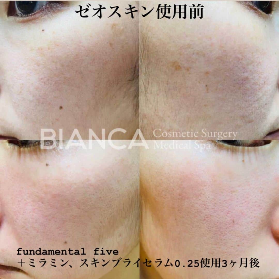 辻沢由有（BIANCA CLNIC 表参道院 院長）のインスタグラム