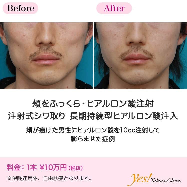 高須クリニックのインスタグラム