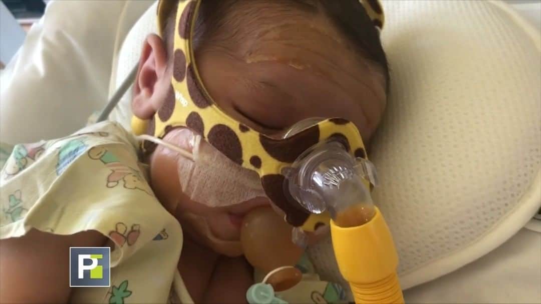 のインスタグラム：「Rafita, el bebé que necesita el medicamento 'más caro del mundo' ($2.1 millones) para poder vivir.   El bebé fue diagnosticado con Atrofia Muscular Espinal (AME) en su forma más agresiva. Por eso necesita con urgencia Zolgensma, el medicamento 'más caro del mundo', cuyo precio es de $2.1 millones, antes de que cumpla los 2 años. Sus padres solicitan la ayuda de todos.  @borjavoces nos contará esta tarde a las 5pm/4c en #PrimerImpacto cómo está el estado de salud del pequeño.」