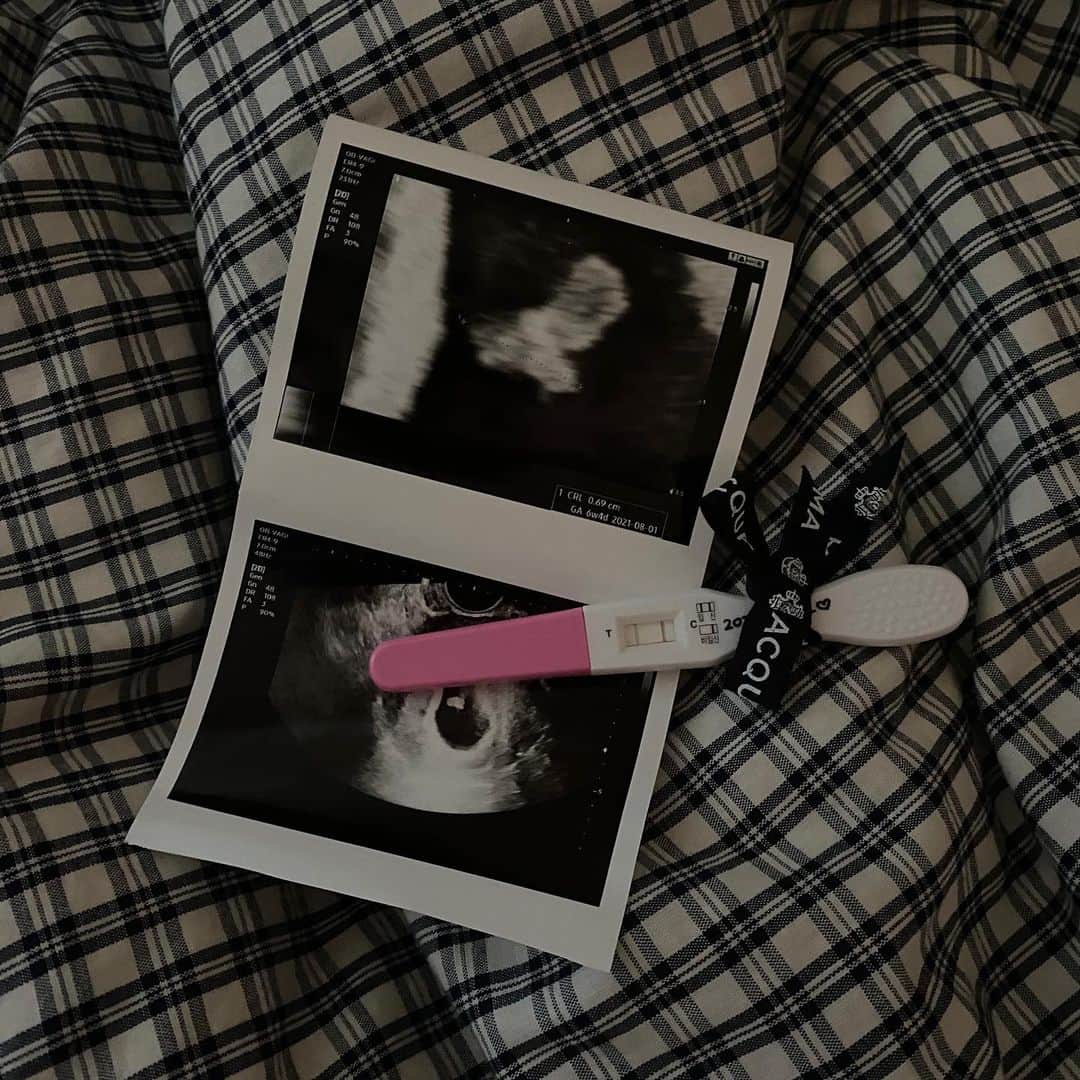 キム・ダヘのインスタグラム：「여러분.,, 저 엄마가 되었어요... 👶🏻 요즘 운동을 안하는이유 식단 안하는이유 등등 여러가지 이유의 답.. ㅎㅎㅎ 다들 안정기지나면 올리라고했는데 원래 나는 내맘대로 하는 스타일,, 또 성격이 급해서 못참음...(?) 그리고 빨리 공유하고 수다떨고싶어섴ㅋㅋㅋㅋㅋㅋ  이사가면 가지려고했는데 바프끝나자마자 아기가 생겼지뭐에오,,  오늘 병원가서 아기 심장뛰는것도 보고 주수에 맞게 아주 잘 크고있다는 선생님말듣고 올려보아요..,  요새 제가 디엠답도 잘 안하고.,? 그랬는데 ㅠㅠㅠ 요즘 입덧인지먹덧인지모를 그 중간단계의 어떤것이 찾아와서 폰을 오래보거나 신경쓰이는일있으면 너무 어지럽고 토할거같더라구요 차타는것도 너무 토할거같고... 단순히 임신해야지~~ 생각했을땐 만삭때만 힘들고 애기낳을때만 아픈거라고 생각했었는데 초반부터 배는 콕콕 찌릿찌릿 계속 잠이 쏟아지고 그렇게 좋아하던 소고기는 인스타그램에서 사진만봐도 토할거같고... 부모가 된다는게 정말정말 쉽지않더라고요! 이세상 모든 엄마들 진짜 대단해요ㅠㅠ  어쨋든 이러한 이유로 제가 답이 느려도 조금만 양해부탁드려요..🤍🤍  컨디션좋을때 마니 수다떱시당 키키 #까꿍이_이모들한테인사해#임밍아웃 #아직배나올시기아닌데배왜나옴#내살」