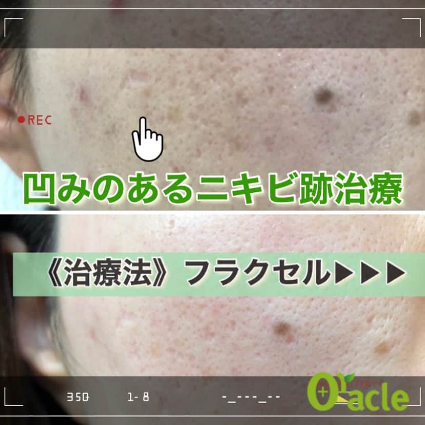 オラクル美容皮膚科東京新宿院のインスタグラム