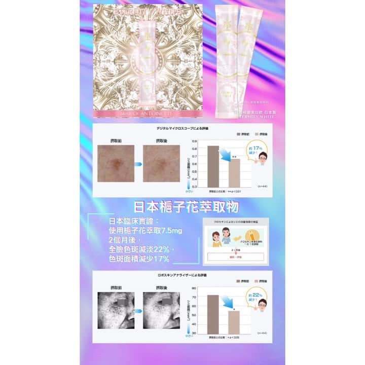のインスタグラム：「⚜️MOA 貴婦奢華系列⚜️ ⚜️ 袪斑極緻美白飲 ⚜️🇯🇵日本製 ETERNITY WHITE  Staff K 每日3條 ，十日既效果 斑同埋紅血絲都有明顯既效果，膚色都明顯提亮袪黃，臉上瑕疵都明顯減少，皮膚望落更乾淨！  袪斑每日3條會係最快速！ 從此不需要再用濾鏡，肌膚白裏透光，水感透白，再沒瑕疵。 美白產品一向只需成分上分析，含量及實際功效。 抗自由基：GliSODin®法國專利香瓜萃取 抗糖化：櫻花萃取 抗光老化 ：蕨類植物抽出物 抗黑色素沈積：L 半胱氨酸 抗色斑黃褐斑：梔子花取出的藏紅花酸 抗暗沈氧化：谷胱甘肽 超重磅明星成分： ⚜️GliSODin®法國專利香瓜萃取⚜️ 全世界第一個經臨床證實口服有效『可以經由消化系統吸收的超氧化歧化酶SOD』 專利小麥蛋白包覆技術，真正吸收，不會因胃酸破壞失去活性。 法國製造，世界8項功效專利及科學和臨床研究。 GliSODin®抗氧化能力為松樹皮的400倍,蝦紅素的20倍, 效用為維生素Ｃ的 8,000 倍，啓動自我恢復力，可有效抵御自由基的侵害，並可有效防止老化，減少老化痕跡。 外用護膚的最強對抗自由基C60富勒烯可以使用C60系列，但內服用護膚的最強對抗自由基就會是GliSODin® 超氧化物歧化酶。 ⚜️ 日本櫻花萃取 專利櫻花萃取－咖啡酰葡萄糖及槲皮素糖苷 使用專利櫻花萃取30日後，肌膚明顯保濕度提升，減少水分流失肌膚炎症減少，總皺紋亦減少8%。 有顯著的抗糖化作用，減少「糖化終產物（AGEs）」的產量，擊退暗黃膚色， 維持肌膚年輕鎖水能力及光滑有彈性，糖化反應與年齡膚質都沒有關係，任何年齡都需面臨的問題，所以肌膚糖化，就會導致老化！ 肌膚領域的糖化作用，過多的糖分就會附著在膠原蛋白上，使膠原蛋白斷裂或紊亂，導致肌膚鬆弛、水分流失、失去緊緻度、膚色變暗沉、皺紋變多。 ⚜️L-半胱氨酸（日本產 ） 抑制真黑色素生產的一種胺基酸，使肌膚變得更白晢明亮。 透過調節肌膚更新週期，加速黑色素代謝，令面色剔透亮白，減淡色斑。 ⚜️ 谷胱甘肽（圓酵母精華）日本產  穀胱甘肽GSH是一種三胜肽，100%天然發酵生產，萃取至98%高純度之「圓酵母精華」，100%小腸直接吸收；是人體重要的抗氧化物，具有阻斷黑色素生成的作用。 令肌膚重新透出光感淨白肌能使肌膚白皙透亮，打造亮白肌，因此，又被稱為『吃的美白針』。 日本官方證實：口服補充穀胱甘肽的確可以被人體吸收利用、提高體內穀胱甘肽濃度 證實穀胱甘肽可抑制皮膚黑色素生成，使皮膚亮白，同時也具有改善皮膚皺紋、皮膚彈性和斑點的效果。 ⚜️ 水龍骨(polypodium leucotomos)的蕨類植物萃取 主要防光老化，預防暴露於陽光紫外線下過久所形成的色斑和皺紋。  實驗報告顯示能有效預防因紫外線照射皮膚所引起的傷害,如深層細胞的損傷所導致皮膚出現光老化現象的 DNA 損壞、皺紋、鬆弛皮膚以及皮膚發炎等。 ⚜️ 梔子花萃取的藏紅花酸（日本產 ） 日本臨床實證： 使用專利梔子花萃取7.5mg 2個月後，全臉色斑減淡22%，色斑面積減少17% 於接受紫外光照射之4小時前，使用專利梔子花萃取15mg ，經24小時照射後，紅斑產生抑制20%，紫外線傷害引發之炎症及傷害。 特別適合： 追求美白與美肌兼顧的您 　 希望在炎夏得到美白護理的您 　 受膚色暗沈困擾的您 　 擔心出現色斑及雀斑的您　 由體內極速給予肌膚透明感  追求全身透亮美白的您 不適合使用外用美白產品的您 一般美白丸已不能滿足到的您 曬黑之後難以回復原狀的您 基礎防護：1日1包 建議：1日2包 （早晚各一） 追求最快速卓越效果：1日3包 （早午晚各一） 建議早上服用可充分發揮配方其 抗氧化防止紫外光傷害之作用 如進行日常早上活動請預早半小時使用。 如進行暴曬活動最好預早4小時，一次過飲用2包，有效抑制黑色素形成，不易曬黑及曬傷。 成分：每包  建議：1日2包 （早晚各一） L 半胱氨酸：120mg GliSODin®法國專利香瓜萃取：115mg 谷胱甘肽（圓酵母精華）: 125mg （美白針主要成份） 日本櫻花萃取：50mg 梔子花取出的藏紅花酸：7.5mg  蕨類植物抽出物：125mg ⚜️MOA 貴婦奢華系列⚜️ ⚜️ 袪斑極緻美白飲 ⚜️ ⚜️$599/28條  ⚜️$1078/56條 （9折） ⚜️$2037/112條 （85折） 見效時間視乎個人新陳代謝 年紀越大所需時間越長和色斑深淺程度 請給予耐性並必須每日使用足夠物理防曬 色斑越早處理越好 若色斑較淺色，即只是卡在表皮層 大約14至28日 黑色素便會開始顯著淡化 約兩個月便消退 若色斑較深色，即是根部已經卡在真皮層 需要更長時間 建議服用3個月或以上，效果最為理想 #moa好評 #modeofantoinette」