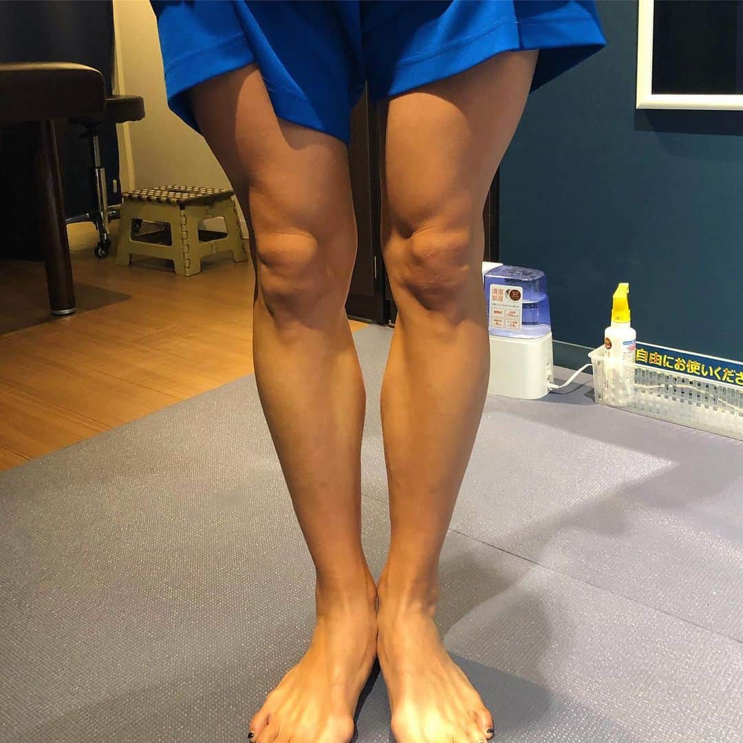 佐野千晃のインスタグラム：「1枚目の膝が良い調子の時﻿ ﻿ 2枚目の膝が痛みを感じてる時﻿ ﻿ 左側(右脚)が見た目でわかるぐらい落ちてるのがわかる。﻿ ﻿ 走り方とか筋肉の使い方とかケアの仕方とか、、、色々改善点があるからまだまだ伸び代、、、って思おう。﻿ ﻿ 自分の走り方や練習だけでなく、自分の身体の状況も理解しないと強くなれないな、、、って思った。﻿ ﻿ #run #running #marathon #フルマラソン #マラソン #マラソン女子 #人生自由自在 #走る女子 #ファッション #ウェア #楽しく走る #ランニング #ジョギング  #膝」