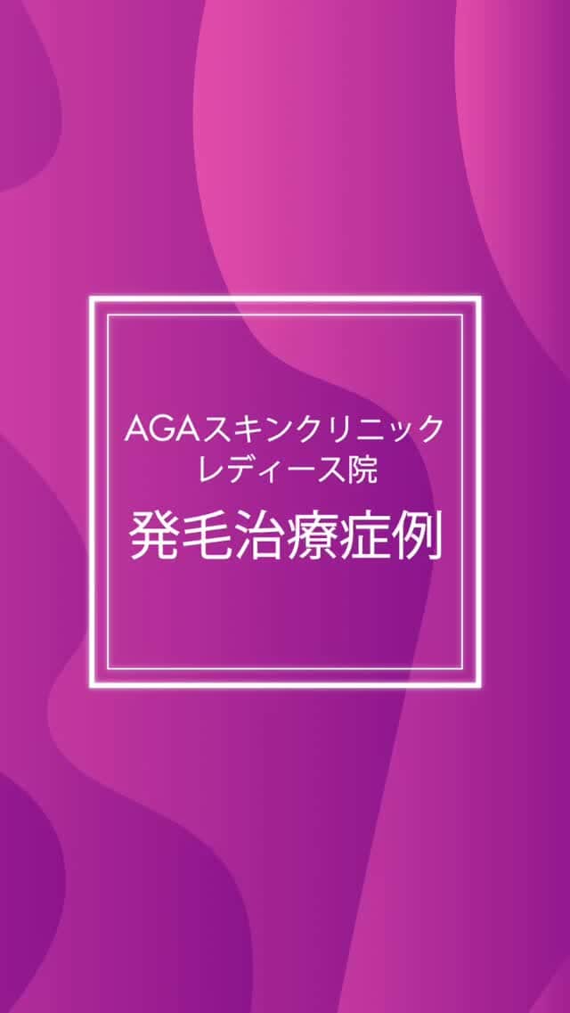 【公式】AGAスキンクリニックのインスタグラム