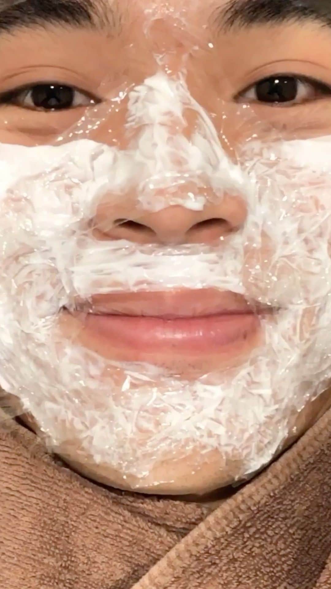 岡田隆之介のインスタグラム：「僕はお肌にコンプレックスを抱えていて特にニキビ！ そんな僕はついに気になっていた肌治療のダーマペンというものを　@leticia_clinic さんにて受けてきました。 ダーマペンはお肌に穴をあけることで表皮細胞や繊維芽細胞に刺激を与え、お肌本来の修復作用でコラーゲンやエラスチンの増殖を促進します。 極細の細かい針で穴を開けその自己治癒で肌をきれいにさせる治療です！  前置きが長くなりましたが、こういうのは初めてで緊張と不安を抱えて診察してもらいましたが、まず始めに肌診断機という他の病院ではなかなかない機械を使い先生が優しく丁寧に診察してくれて自分に合う治療をしっかりと見つけてくれます。  施術は麻酔から丁寧にしてくれて痛みに敏感でビビりな僕が寝れちゃうくらいリラックスして受けられるとても素晴らしかったです😂 24時間経てばメイクもオッケーということでダウンタイムもほとんど気にせずお仕事に行けるのは嬉しいです☺️ 僕はそんなに赤くならなくて次の日から肌の調子が良く感じられました。 僕は絶対通うと心に決めました❗️ 初回の方はトライアル料金というものが気軽に行くことができると思います。 このほかにも沢山の治療があるみたいなので是非気になった方は見てみてください👀  詳しくは公式のInstagramやホームページからご参照ください。  #ダーマペン」