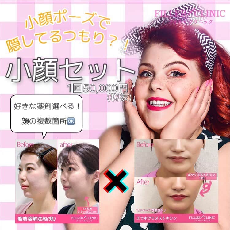 恵比寿フィラークリニックのインスタグラム