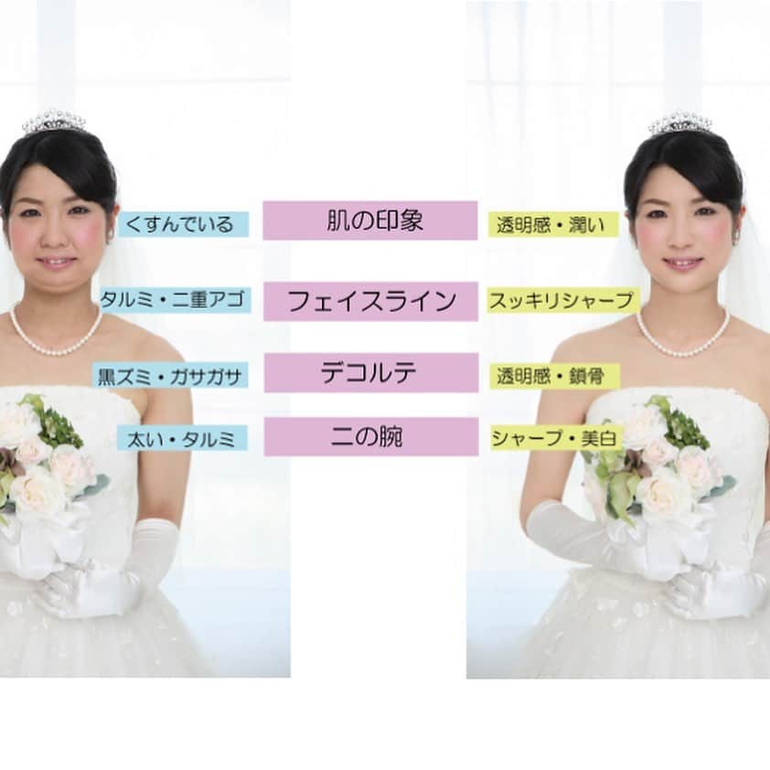【公式】ブライダルエステサロンさんのインスタグラム写真 - (【公式】ブライダルエステサロンInstagram)「﻿ *･゜ﾟ･*:.｡..｡.:*･*:ﾟ･*:.｡. .｡.:*･゜ﾟ･**･゜ﾟ･*:.｡..｡﻿ ﻿ 長野県佐久市のブライダルエステサロン「Ayu-Natah アユナタ」今ならブライダルエステ体験コース5,500円〜♪ ※詳しくはプロフ欄ホームページURLをクリック‼︎💐驚異のリピート率 95.8% ﻿ 佐久平駅徒歩7分（10:00～20:00 定休日：火曜）﻿ ※フォトウェディングにもぜひ！﻿ ･*:.｡..｡.:*･*:ﾟ･*:.｡. .｡.:*･゜ﾟ･**･゜ﾟ･*:.｡..｡.:﻿ ﻿ ●ブライダルトライアル﻿  まずはトライアルコースでアユナタを体感しましょう﻿  その際にお悩みや予算の相談も気軽にできます。﻿ ﻿ １箇所￥5,000　　2箇所￥8,000　　3箇所￥10,000﻿ （各税抜）﻿ ※体験コースは挙式の一か月前までの受付です。﻿ ﻿ 内容は﻿ （二の腕、お顔、ウエスト、お背中、ワキ肉）﻿  上記の中から、ご希望の箇所をお選びいただけます﻿ ﻿  ▶お申込み・詳細はプロフ欄から花嫁様向けホームページで!!﻿ ﻿ （※式前日のみエステをやりたいというお問い合わせをいただくことがありますが、﻿ 大切な日の直前にお肌に何かあってはいけませんのでお引き受けはいたしかねますのでご了承ください）﻿ ﻿ 〜〜〜〜〜〜〜〜〜〜〜〜〜〜﻿ 結婚式/フォトウエディングの花嫁﻿ 🌺ぜひご一読ください🌺﻿ ﻿ ﻿ 挙式は決まっているけどエステはまだの方。﻿ ﻿ 早くエステを始めることをオススメします！﻿ ﻿ 理想的には結婚が決まったら、﻿ 式場選びと同時期ににエステサロン探しです。﻿ ﻿ ﻿ 挙式準備に時間がかかるように、﻿ キレイになるためにも﻿ その準備には時間が必要です。﻿ ﻿ 「初めてのエステで何から始めればいいの？」﻿ という方も多くいらっしゃいます。﻿ ﻿ 各サロン様で体験コースを用意されているところも多いかと思いますので、﻿ 実際に体験されて雰囲気などみながら﻿ 通われるサロンをお決めになられるのも一つの方法。　﻿ ﻿ その際にはぜひ当店には﻿ 一番最後にご予約いただければと思います。　﻿ ﻿ 私たちのサロンでは﻿ ブライダルエステは単なるメニューではなく、﻿ 大切にしているプロセスの共感。﻿ ﻿ 花嫁様は挙式に向けて色々と不安や喜びを感じながらその日を迎えられます。﻿ そんな花嫁様に寄り添いながら、﻿ 挙式当日に最高にキレイな花嫁になっていただくことに使命感を持ってお任せいただいております。﻿ ﻿ そのプロセスが私たちは好きなんです。﻿ ﻿ ですからずっとブライダルエステに注力してきています。　﻿ ﻿ ﻿ これまでも沢山の花嫁様とお会いしてきました。﻿ ﻿ ご結婚されてからもそのままずっと通ってくださる方も多くいらっしゃますし、﻿ お子様ができたとか嬉しいご報告もわざわざいただくことも多くあります。﻿ そんなサロンですので、貴女様からブライダルエステをお任せいただけましたら、﻿ 精一杯お世話させていただきますので﻿ ぜひアユナタもご検討くださいませ。﻿ ﻿ 当店でブライダルエステをお任せいただく﻿ 花嫁様の約８割は初めてのエステ。﻿ ﻿ 「こんなにエステっていいって知ってたら﻿ もっと早く始めれば良かった」﻿ こんなお声が良く聞かれます。﻿ ﻿ まずはブライダルエステトライアルを﻿ ホームページからご予約ください。﻿ ﻿ 貴女様とお会いすることを楽しみにお待ちしております ﻿ ﻿ ※フォトウェディングの花嫁様﻿ 最高の一枚を遺しましょう。﻿ 単にお肌などキレイになるだけでなく、﻿ その日に向けてキレイになろうという行動が幸せオーラを纏えると思います(●︎´▽︎`●︎)﻿ ﻿ ﻿ ﻿ ﻿ *･゜ﾟ･*:.｡..｡.:*･*:ﾟ･*:.｡. .｡.:*･*:.｡. ﻿ ﻿ ﻿ 結婚式当日﻿ ﻿ 沢山のゲストから﻿ アナタは祝福をされることでしょう﻿ ﻿ と、同時に﻿ アナタのお背中や﻿ 二の腕にも﻿ 沢山の視線が集まります﻿ ﻿ 自分史上最高なアナタで﻿ 自信を持って挙式を迎えるために﻿ ブライダルエステです﻿ ﻿ 自己流のお手入れではなく﻿ 大切な日だからこそ﻿ 美容のプロにまかせましょう﻿ アユナタではこれまても沢山の花嫁様の﻿ キレイをお手伝いして多くの実績があります﻿」1月10日 7時47分 - ayunatahwedding
