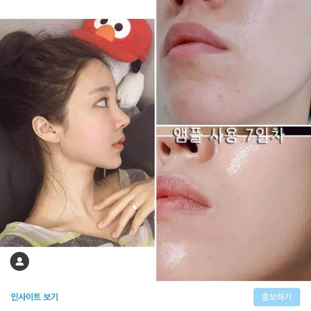 チョ・ミニョンさんのインスタグラム写真 - (チョ・ミニョンInstagram)「• 티아크 앰플 공구 종료 다음 재 공구에 만나요•」1月10日 16時54分 - xxjominxx