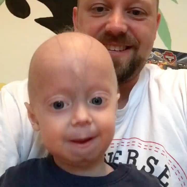 ケヴィン・マクキッドのインスタグラム：「Repost from @lukes_dad78  Luke and his family are amazing . Luke has a rare illness that makes his body age faster . Let's welcome Luke and send him our love instead of hearing mean and hurtful comments.  Luke’s future won’t be an easy one because he will look different than what we would describe as “The Norm”. However, we hope deeply that most of the reactions will be positive and not hurtful.  Would you join us on our journey through Life and give us a follow?  #supportluke   Thank you for listening and greetings from Germany. 🤝 🌍  Ronny • 🇺🇸Good night 🇩🇪Gute Nacht 🇫🇷Bonne nuit 😉  FOLLOW @lukes_dad78」