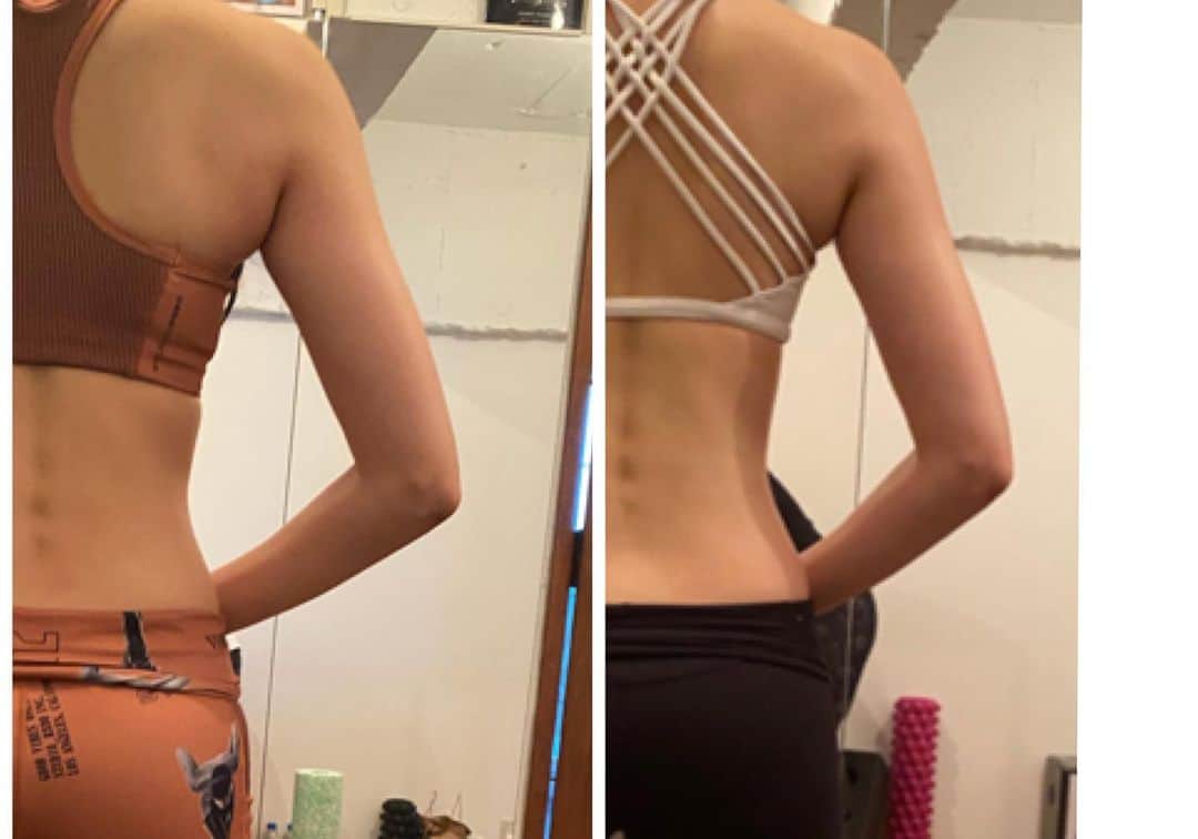FitnessPlanner 星野由香さんのインスタグラム写真 - (FitnessPlanner 星野由香Instagram)「2ヶ月での変化✨ 元々、背骨の側湾を持ちながらも 少しずつ変わってくる体を楽しみながら続けてくださっての変化  人の体の変化って、すべてが変化のプロセス中だからこそ面白いです✨  左側の腕の変化は比べてみると違いがわかりますね。 肩甲骨もシルエットが見え始めてる。 こういう変化がリアルだと思いますし、自然とだっていただいた時に足指の向きも変わってきました。 小さな変化かもしれませんがご本人の満足感や体の使い方を落とし込んでいくことの醍醐味がこの仕事ではまだまだ奥深くて探究がつきないところです✨  #ほぐピラ」1月11日 20時33分 - yuka.hoshino222
