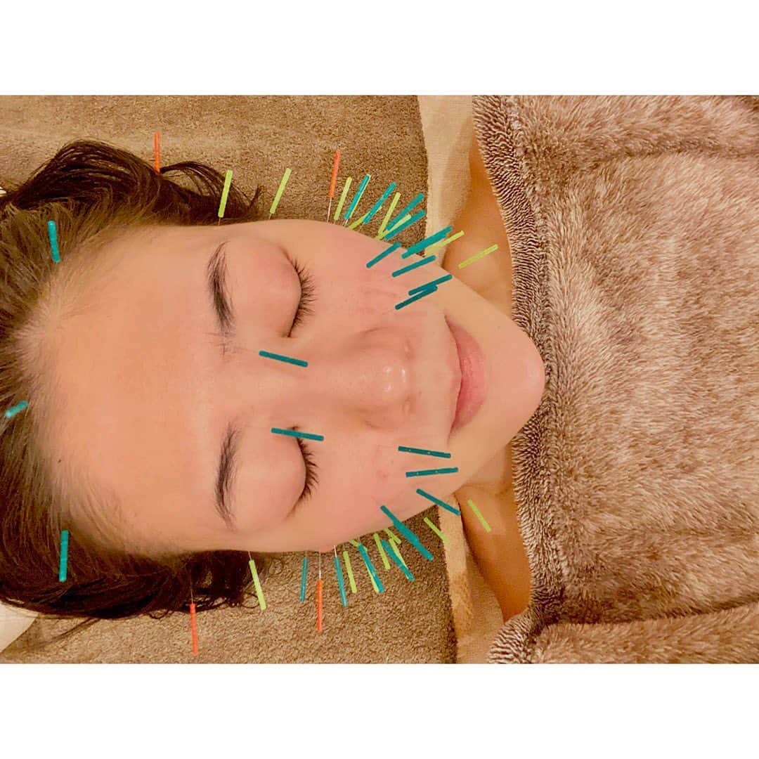 のインスタグラム：「Thank you❤️ @t.rie_09 明日はビューティーの撮影なので✨ 鍼、マッサージ、超音波、お灸、石膏パック、遠赤外線マットで発汗などなど… 頭の先から爪先まで整えてもらいました。 私の体はりえちゃんに操られています🤣w  #acpuncture #cosmeticacupuncture #me #esthetic #beauty #helthy #instabeauty #maintenance #maintenanceday #beautyday #massage #skin #antiaging  #鍼 #美容鍼 #鍼灸 #エステ #美容 #美容デー  #中田奈沙 #マッサージ #小顔 #美肌 #アンチエイジング #エイジングケア #美白」