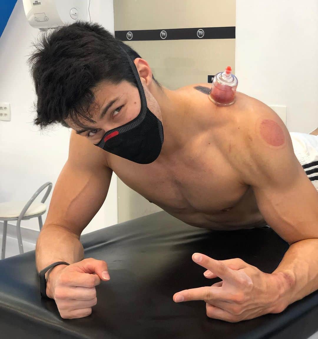 アルトゥール・オヤカワ・マリアノのインスタグラム：「🙏🏻 @caiobona  . #fisio #ventosa #tired #fisioterapia #ombro」