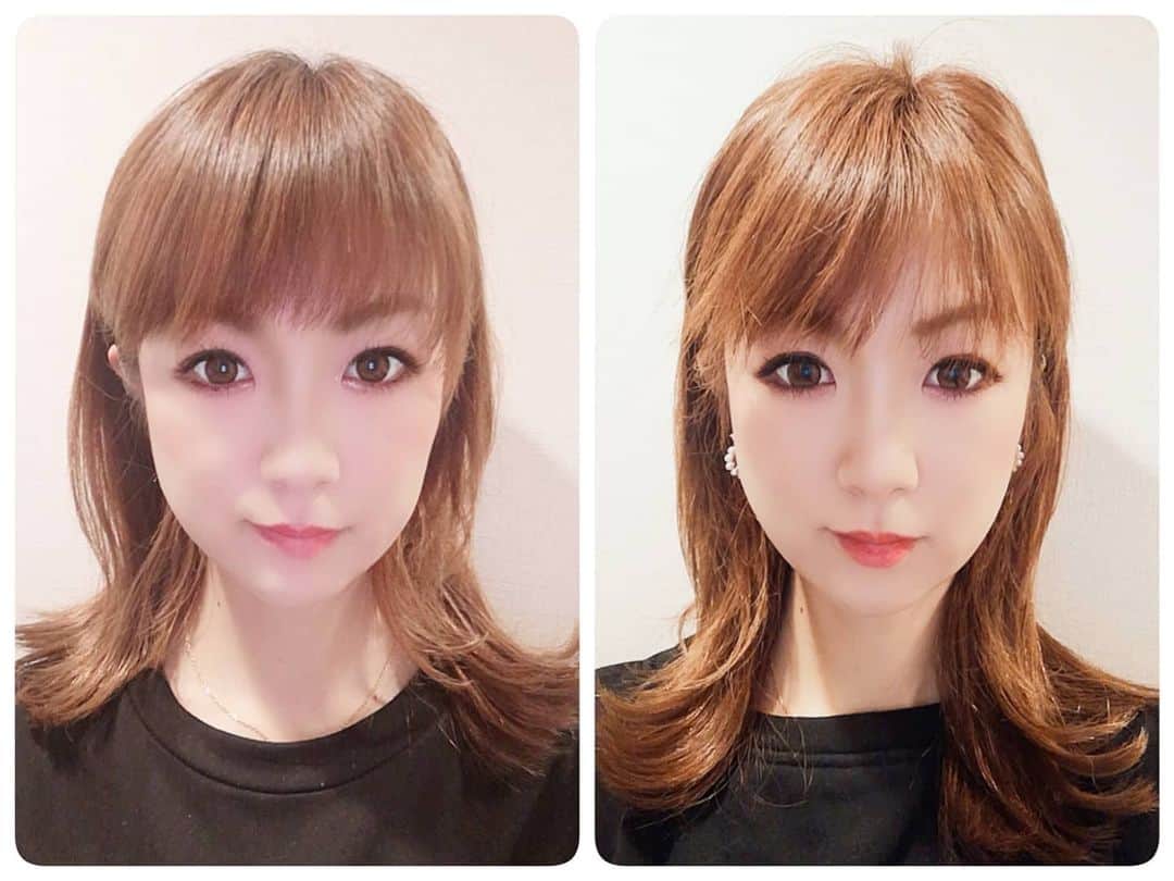 中島彩のインスタグラム：「ハイフ4回目レポ💕　 並べて比べると変化がわかりやすい😚 ハイフを始めてからむくみにくくなりました😘 代謝落ちてか全然痩せなくてダイエット低迷中ですが、痩せた？と聞かれることも度々😝💦 それは絶対ハイフのおかげ❤️ そして合わせ技でフォトも受けたのでさらにきゅっと毛穴も引き締まって小顔効果アップ✨ メイクのりも良くて、マスク揺らぎも怖くない😍 @maison_de_m_misa  年内最後の施術おさめ😘 年末年始太りしないよう気をつけて、また年始早めに行かなくちゃ‼️  施術後いただけるドリンクが酵素ドリンクで感激～😍最後まで美意識高まる😏💕 サロンがクリスマス仕様で可愛かったなぁ❤️  #ハイフ　#アンチエイジング　#エイジングケア #ビフォアフ　#ハイフエステ #ビフォアフ写真 #ビフォーアフター　#エステサロン　#阪急塚口」