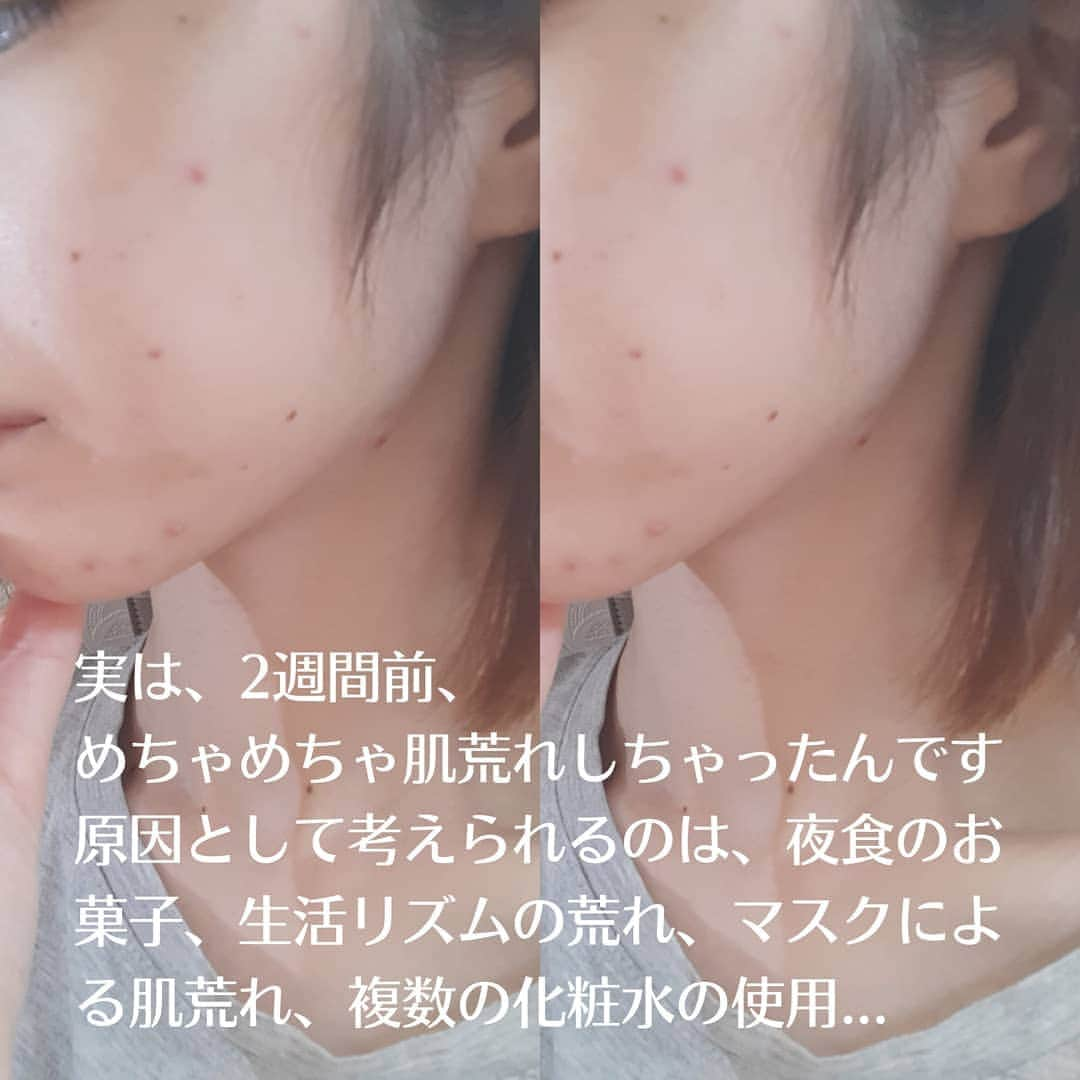 菅原京香さんのインスタグラム写真 - (菅原京香Instagram)「2020.12.20  今日、紹介するのは、無添加化粧水💄  肌荒れしちゃって、何本かサンプルでいただいたこの化粧水使ってみたけど、肌だいぶマシになりました😳  勿論、他の美容液とかのお陰もあると思うけど、私のお肌にはあってたみたい👍  4枚目の写真までよかったら見てください～✌️ 4枚目は、素っぴん無加工！！！  #無添加化粧品 #エポラーシェ #クレンジング #クダモノトケイソウ #ウメ果実水 #リンゴ果実培養細胞エキス #ピューローションオメガ #オメガ #EPORASHE #monipla #eporashe_fan」12月20日 22時17分 - kyoka_collection_