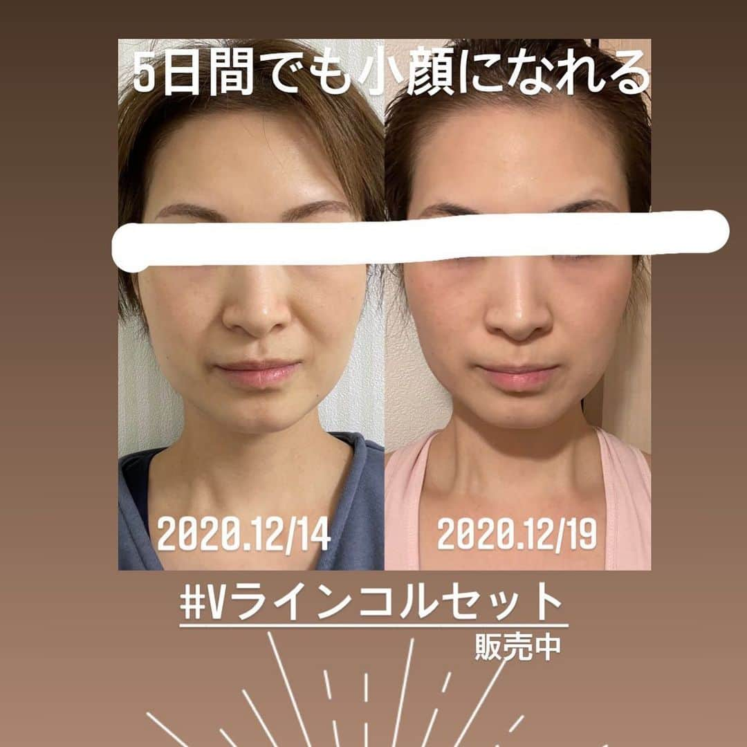 ブランシュール銀座店さんのインスタグラム写真 - (ブランシュール銀座店Instagram)「フェイスラインで印象が変わります✨ 来年40歳。がんばるぞっ。  #セルフケア#小顔#Vラインコルセット #V3ファンデーション#v3アグレッシブカッサ」12月21日 13時07分 - blancheur.ginza