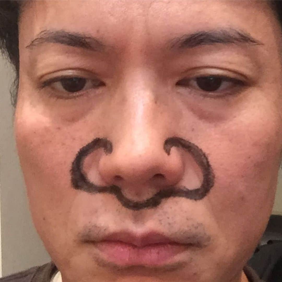 のインスタグラム：「耳鼻科に行きました。来年鼻の手術になりそうです。鼻が大きくなってもよろしくお願いします🥺」