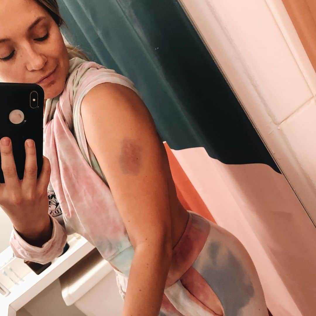 バネッサ・レイのインスタグラム：「The sign of a good day at work: when your bruises match your pj’s. #jamko #eddiejanko #bluebloods #idomyownstunts ... (sometimes)」