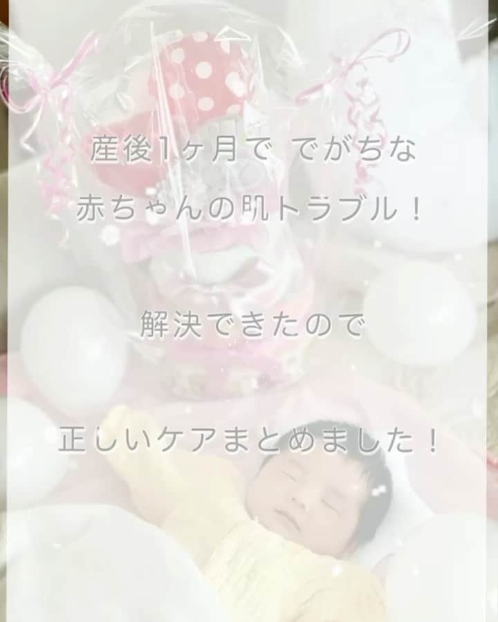 三佐和あやのインスタグラム：「肌の弱いぱくちゃん のために 色々調べたり ママの肌で試したりしながら、肌トラブルを解決できたので、まとめました！  1番悩んだのは お顔に赤いポツポツができたこと。 どんどん増えてひどくなるので かわいそうで...😭 お風呂上がりの保湿と塗り薬で治りましたけど 2週間ほどかかりました💦  フエナゾールは1ヶ月検診のときに小児科の女医さんから処方してもらったもの。 なかなか効いてこなかったので、 キンダベートを塗ってみたら こっちのほうがすぐ効いたので、 1日 2回ほど塗りました。  キンダベートは妊娠中に わたしの首周りにできたかゆかゆに処方されたものなのですが、アトピーがひどくなったところに塗ってもよく効いたやつで、 赤ちゃんのおしりかぶれにも塗って大丈夫もいわれていたものです。  キュレルの頭皮保湿ローションは、 頭皮のカサカサがひどくなった時に 薬局で買ったものです。 市販のものは 薬ではないので その場しのぎにしかならないと 小児科の先生に言われたのですが、ほんとにもう見事にカサカサだったので、（うろこみたいに） お風呂上がりに塗りました。  ぱくちゃんは髪が長いので 塗ると髪がべちょべちょになっちゃって、、、 さらに フエナゾールを塗ると もうリーゼントみたいになって かわいくない😭辛い💦  頭皮のカサカサの原因は ②乾燥が原因 に当たったので、 まず、お風呂のお湯の温度を下げました。  冬に産まれた子を育てるの初めてだったので、寒いだろうと思って 温かめでベビーバスで入れてあげていたのですが、 それが熱かったみたいで 38度にするようにして、あまり長湯させないようにしたら、お薬と併用で わりとすぐ良くなりました。温度が原因だったと思います。  デリケートすぎて、なんて難しいんだろう😅」