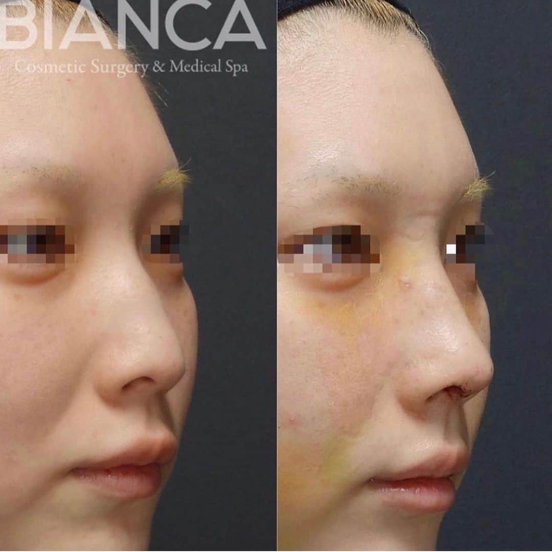辻沢由有（BIANCA CLNIC 表参道院 院長）のインスタグラム