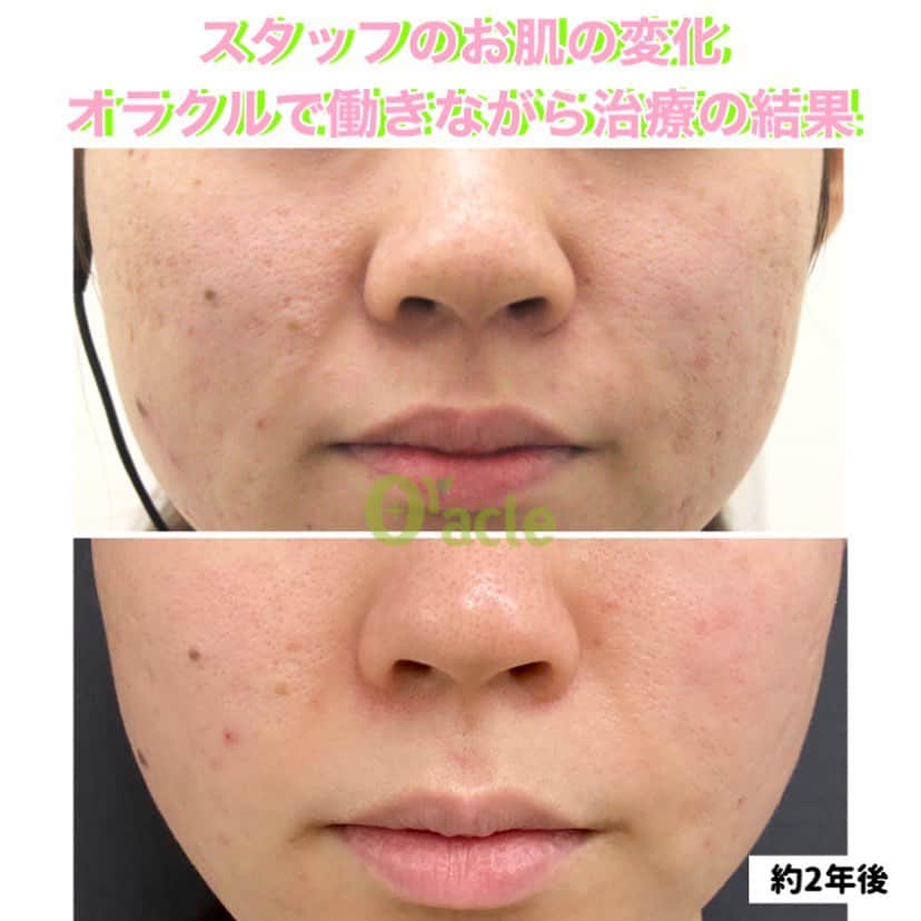 オラクル美容皮膚科東京新宿院のインスタグラム