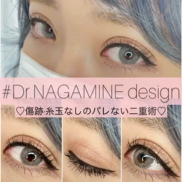 東京美容外科公式のインスタグラム：「永峯先生の糸玉なしのバレない二重術✨オシャレでハイクオリティ、ハイセンスなふたえに仕上がります👀💄😍 #Repost @dr.nagamine with @make_repost ・・・ * ♡二重整形なら永峯祥子♡ 私が自然で可愛い目元を作ります😋 * 〜糸玉傷跡なし✨直後からバレ辛い二重術〜 * ☑︎シークレットループダブル(二重埋没法) * まぶたの表面に傷を作らずに二重を形成します。施術直後から腫れが出ずらくお化粧も可能なので、ダウンタイムを極力抑えたい方におすすめの方法です！ * 写真 1枚目:施術2週間後 2枚目:上 施術前、下 術後2週間 * ☑︎リスク 腫れ、内出血、左右差、角膜損傷(稀)など * * 【♡全国からインスタ、YouTube指名殺到中😋♡】 【♡大手美容外科院長、技術指導医経験あり♡】 【♡女性ならではの美的センスと技術をお届けします♡】 * ———————————————————————— 🧡二重モニター様大募集中！🧡(モニター審査あり) また、目の下のクマ取り、鼻整形、小顔整形もモニター様募集中しております♡ DMでお問い合わせください♡ ———————————————————————— * * #二重整形 #二重整形なら永峯祥子  #二重埋没 #二重埋没法  #シークレットループダブル #美容整形 #美容外科  #アイプチ #アイメイク #美容外科医 #女医」