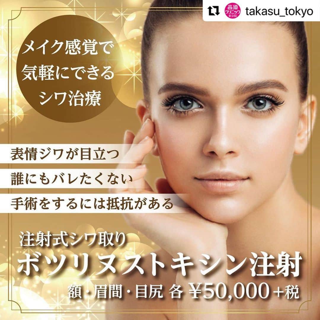 高須クリニックのインスタグラム：「. ━･･━･･━･･━･･━･･━･･━ #Repost @takasu_tokyo ━･･━･･━･･━･･━･･━･･━ プチ整形の代表選手・注射式しわ取り。﻿ その中でも、額の横じわ、眉間の縦じわ、目尻の笑いじわなど、表情のくせによる頑固なシワに効果的なのが、『ボツリヌストキシン注射』です。﻿ 表情筋の過剰な動きを和らげることで、しわの原因そのものを断つのが、ボツリヌストキシンの特徴。﻿ すでにあるしわを目立たなくするのはもちろん、将来のしわまで予防することが可能です。﻿ ﻿ 【🌿料金】﻿ ●注射式シワ取り ボツリヌストキシン注射﻿ 額・眉間・目尻・口周り・鼻の根元ジワ・あごの梅干しジワ 各￥50,000（税抜）［全院］﻿ ﻿ 【⚠️副作用・リスク】﻿ ●注射式シワ取り ボツリヌストキシン注射﻿ 内出血（注射針が血管に当たってしまった場合）、妊活・妊娠・授乳中の方への施術不可、眉が下がる、目が細くなる可能性、目が開けにくくなる、眼瞼下垂になる可能性﻿ ﻿ 【ご予約・お問合せ】 ➿0120-5587-10 ※症例写真や施術に関するご質問なども上記までお願い致します。 ﻿ #高須クリニック　#高須克弥　#美容　#美容整形　#整形手術　#整形　#プチ整形　#整形したい　#美容外科　#美容クリニック　#かわいい　#可愛くなりたい　#綺麗　#綺麗になりたい　#美人　#美容好きな人と繋がりたい　#美容好き　#シワ　#シワ取り　#ボトックス注射　#ボツリヌストキシン注射　#表情ジワ　#しわ　#エイジングケア　#ボトックス注射　#wrinkle」