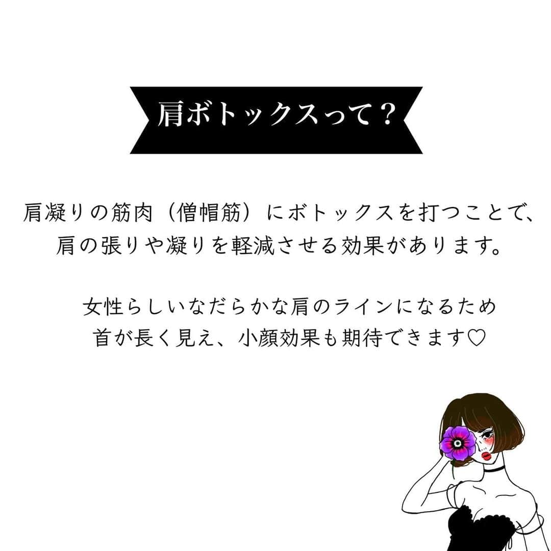a_k_i_n_aさんのインスタグラム写真 - (a_k_i_n_aInstagram)「▶︎▶︎肩ボトックス 実際に受けてみて...  注射を刺す時よりも液を入れる時に 痛みを感じますが我慢出来ないほどでは なかったです☺️ 施術後は肩が何となくダルい感じで 違和感がありましたが、10日程すると そのダルさもなくなり肩の詰まりが 取れたようなスッキリ感を実感😌 2週間経った頃には見た目にもハッキリと 効果を感じることが出来ましたよ♡ 目立った副作用は特にありませんでした🙆‍♀️  本当に肩こりがひどくて自分の首が どんどん埋まっていくような感覚だったので このスッキリ感はたまらなく嬉しい😢❤️  ボトックスは打ち過ぎると耐性が 出来てしまい効果が減弱してしまうので 適切な注入量、間隔を守ることが大切 繰り返しボトックスを打つ事で 効果をより実感出来るそうなので 間隔を空けてしばらく続けていきたいなと 思っています☺️  今回私は @tcbshinyokohama  の真鍋先生　@tcb_manabe に施術して頂きました🤗  参考になりますように、、🎄  #肩ボトックス#肩凝り解消#ボトックス注射#美容外科」12月25日 22時56分 - lucky02181014