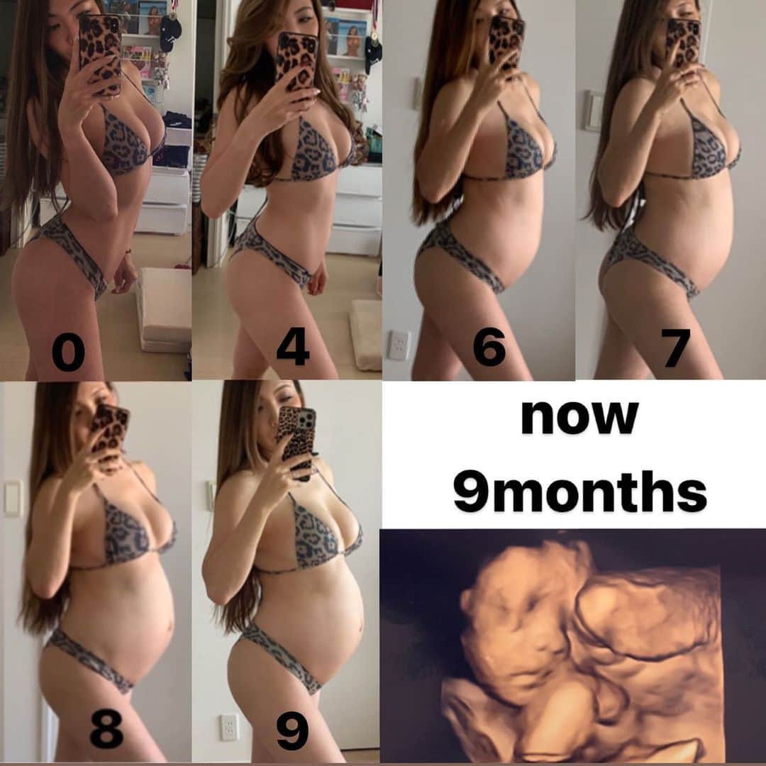 のインスタグラム：「【お腹の変化🤰】 6月に妊娠が発覚してから、 もうあっという間に妊娠9ヶ月！ ・ 今年はコロナなど本当色々大変な事が重なったけど、 今まで味わった事のない妊婦生活、 そしてこれから迎える出産、子育て 不安も多いけど楽しみ❤️👶 ・ この時期のBabyは1週間で約200gも成長するらしい✨ ますますこれからお腹がぽんぽこりんになりそう🤰 ・ ・ ・ #diet#pregnant#matanity#32weekspregnant#pregnancy#baby#9monthspregnant#matanityyoga#yoga #ダイエット#プレママ#妊娠9ヶ月#2月生まれ#2021年2月出産#妊婦#初マタ#妊娠後期#初マタさんと繋がりたい#ママリ#妊娠線予防#マタニティヨガ#妊婦ライフ#妊活ヨガ#産後ヨガ#インストラクター #3D糖質オフ #3D糖質オフレシピ」