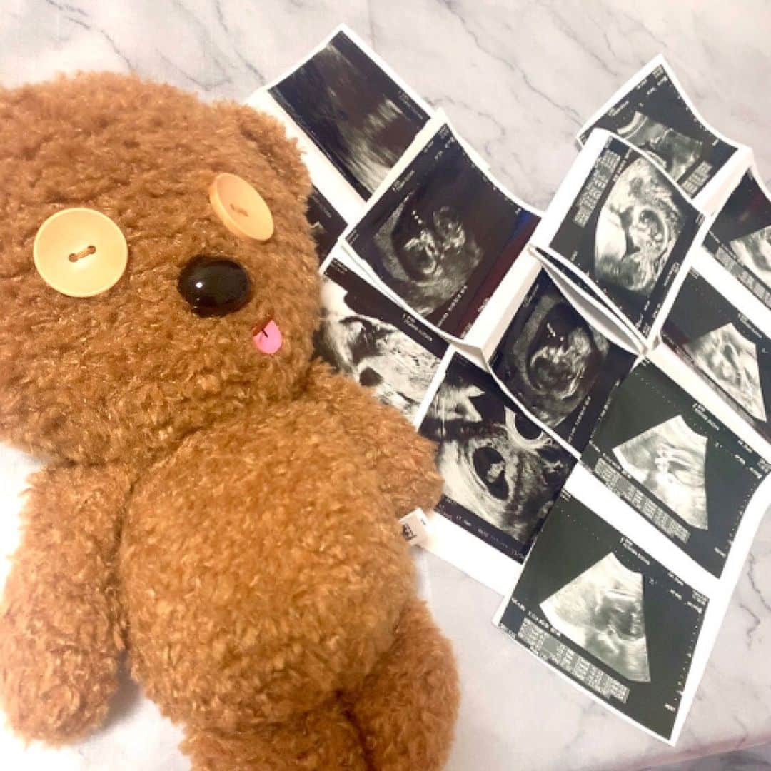 のインスタグラム：「𝑬𝒄𝒉𝒐 𝒑𝒉𝒐𝒕𝒐📸✨  成長　可愛い🧸♥ 次回の妊婦検診から 4Dエコーにチェンジ📸 どっちに似てるかなあ💭  #妊婦#妊娠7ヶ月#マタニティ#BABY #エコー写真 #エコー#MYBABY#LOVE #マタニティフォト#マタニティライフ #ぷんにー#妊娠中期#妊婦さん#👶🏼❤️ #妊婦さんと繋がりたい#妊婦コーデ」