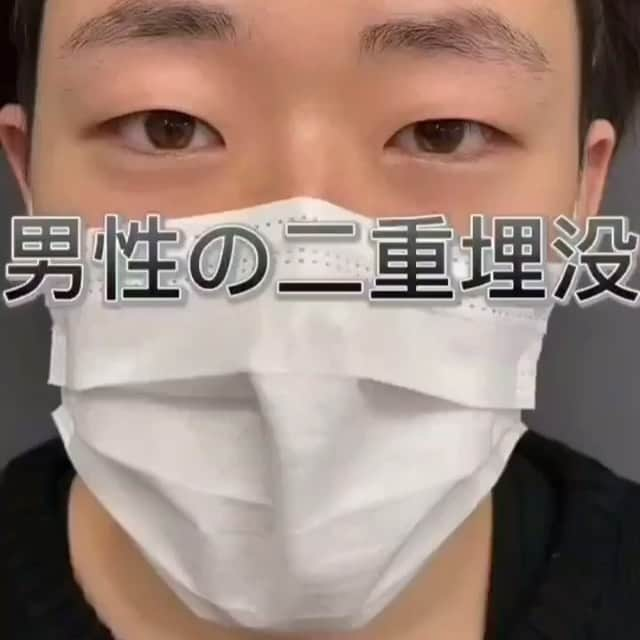 東京美容外科公式のインスタグラム