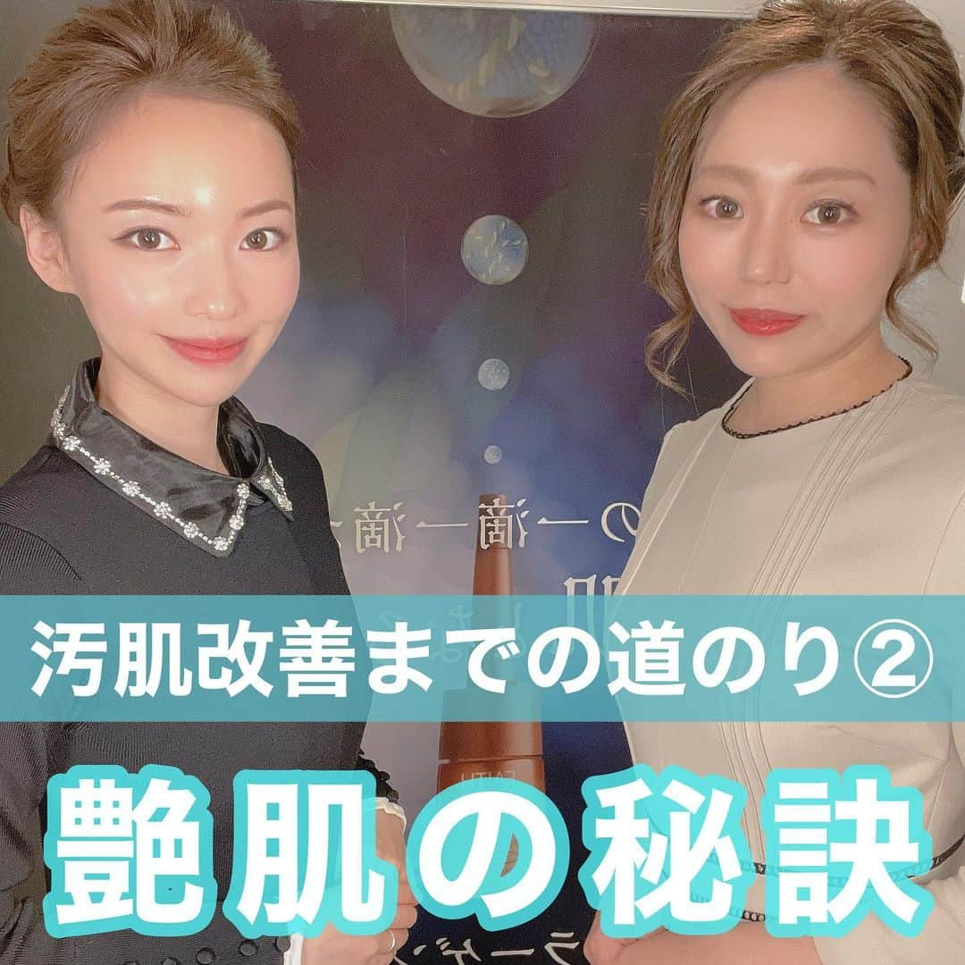 水紀華さんのインスタグラム写真 - (水紀華Instagram)「🌹﻿ ﻿ ﻿ 今では動画や写真のように﻿ 艶々に発光するまでの肌作りができましたが﻿ ﻿ 昔は1枚目の画像のように﻿ 真っ赤に炎症しニキビも治らず﻿ とにかく肌荒れが酷かった。﻿ ﻿ ﻿ ﻿ ﻿ ドラッグストアに売っているものや﻿ ネットや雑誌で良いとされるものを﻿ 片っ端らから試し﻿ ﻿ ﻿ 1回16万円するレーザー治療や﻿ ﻿ 毛穴治療で1回80万以上もする﻿ 特殊なものも受けたことがある。﻿ ﻿ とても高額だったけれど、﻿ 藁にもすがる思いで受けた。﻿ ﻿ ﻿ それでも『綺麗✨』と思える﻿ 肌が手に入らず﻿ ﻿ 『どうしてこんなに頑張ってお手入れしているのに…』と悩んでいました。﻿ ﻿ ﻿ ﻿ 汚い肌を鏡で見るたびに悲しくなり﻿ 肌荒れが治らずに泣いた日は数え切れないほど。﻿ ﻿ ﻿ 友達や同級生にも肌のことを言われたり…﻿ どんどん自信がなくなって﻿ 人と目を見て話すのも怖かった。﻿ ﻿ ﻿ ﻿ ﻿ ﻿ …そんな過去を持つ私も﻿ 『ツヤッツヤですね！！』﻿ と肌を褒められるようになった😭✨﻿ ﻿ ﻿ ﻿ ﻿ 【前回のおさらい】﻿ ﻿ ﻿ 💡常識を疑うこと﻿ ﻿ 💡スキンケアの害を知ること﻿ ﻿ 💡スキンケア用品で肌のバリア機能低下が﻿ 　なかなか治らない肌荒れを作る﻿ ﻿ ﻿ ﻿ ﻿ ﻿ ﻿ ﻿ ﻿ ﻿ 【汚肌改善までの道のりパート②】﻿ ﻿ 肌のバリア機能を強化するために﻿ まずは、クレンジングを変えるところから！﻿ ﻿ ﻿ 💡肌を守りながら﻿ ﻿ 💡汚れを落とせ﻿ ﻿ 💡バリア機能を低下させない﻿ ﻿ ☝️この３つがポイント﻿ ﻿ でも、この３つの条件が﻿ 揃っているものに出会うのは﻿ なかなか難しい⚡️⚡️﻿ ﻿ 実際私も出会うまでに﻿ 何百万円というお金と数年の時間が﻿ かかっている💦﻿ ﻿ ﻿ 信頼できる人に﻿ 教えてもらうのが1番﻿ ﻿ 私もフェースに出会えたのは﻿ @faith.yoko  が教えてくれたから🙏😭✨﻿ ﻿ ﻿ ﻿ 全員に合うものはないからこそ、﻿ フェースが合わない人ももちろんいる﻿ ﻿ ﻿ 他の効果を感じられたスキンケア用品も﻿ 随時紹介していきます！﻿ ﻿ ﻿ ．﻿ ．﻿ ﻿ ﻿ ﻿ ﻿ ﻿ #スキンケア　#肌荒れ改善 #肌荒れ　#スキンケアマニア #スキンケア用品 #スキンケア好きさんと繋がりたい #スキンケア紹介 #脂漏性皮膚炎 #ニキビケア #ニキビ治療　#ハーブピーリング　#ハーブピーリング専門店 #赤ら顔　#ニキビ肌 #ニキビ跡ケア #ニキビ改善　#毛穴ケア #毛穴の黒ずみ」12月27日 8時23分 - mizuki_ah