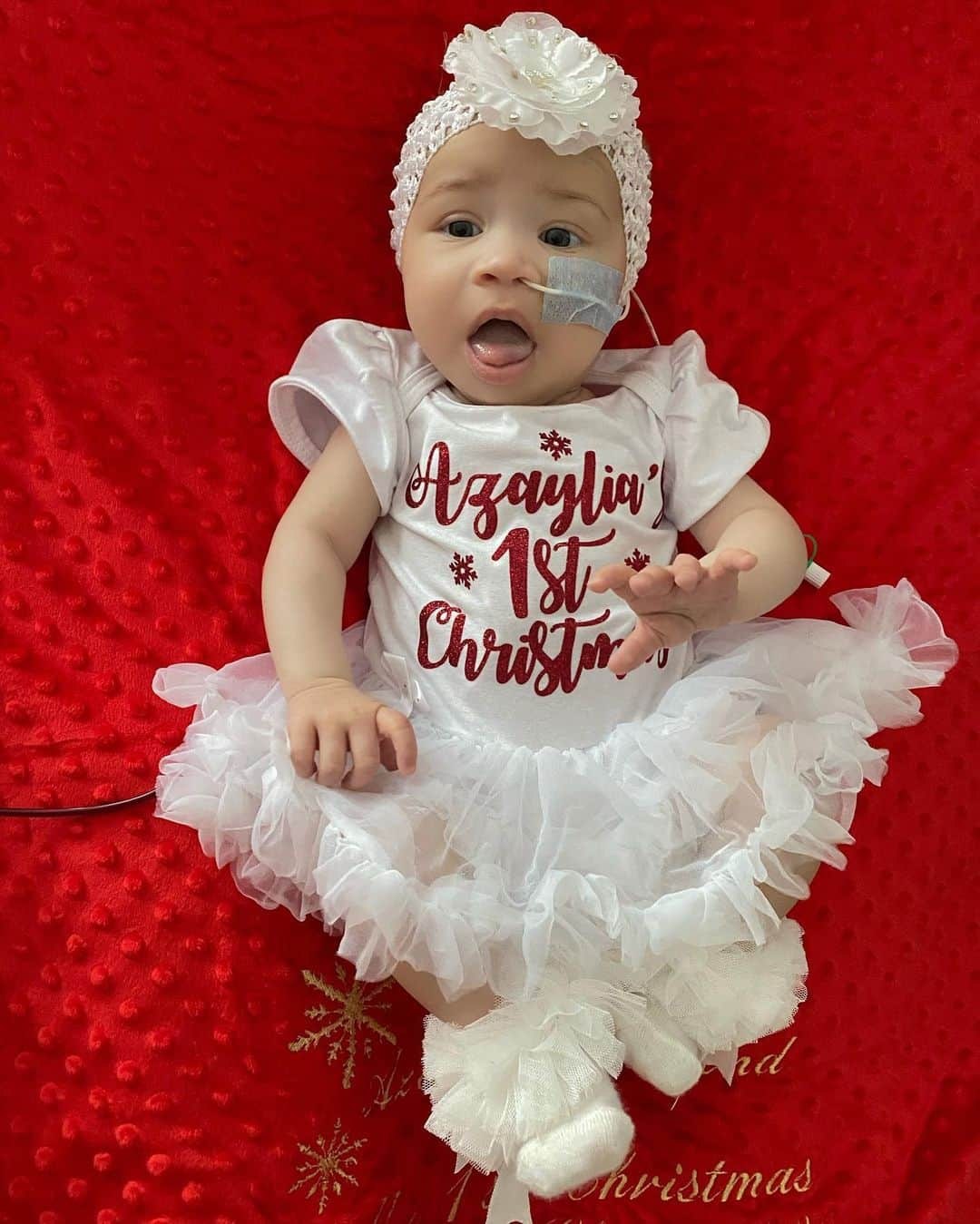 アシュリー・ケインさんのインスタグラム写真 - (アシュリー・ケインInstagram)「I want to take this opportunity to give a massive thank you to everyone who made Azaylia’s 1st Christmas a special one! 💫 . From my family and my friends to my followers, you have all gone the extra distance from amazing gifts to support and positive messages everyday. We can’t thank you enough and I just want you to know we really appreciate EVERYTHING you guys have done and are doing! 💯 . Azaylia has another major surgery in 2 days time fitting another central line into her chest so she has extra infusion points to support all her medication needs. Wish her luck and please keep her in your prayers! 🙏🏾 #LetsGoChamp . #leukemia #leukemiawarrior #leukemiaawareness #azayliadiamondcain」12月28日 0時52分 - mrashleycain