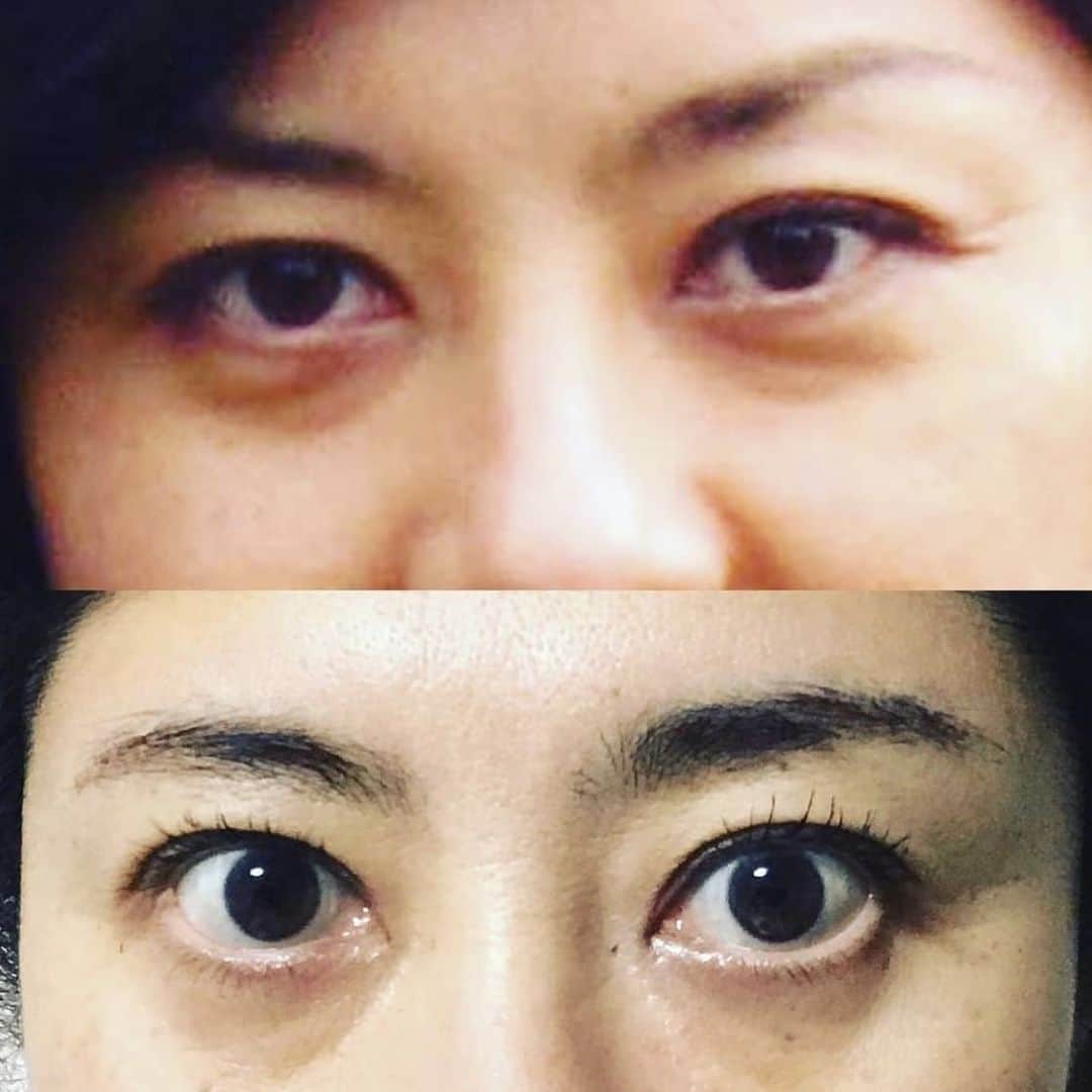 間々田佳子さんのインスタグラム写真 - (間々田佳子Instagram)「2021年まであと数時間 最後の動画は目ヂカラupの コアフェイストレーニングスペシャルバージョンです🌟💕  顔は自力で変えることができる！💪  私が一番みなさんにお伝えしたいメッセージです。  もう年だから…  遺伝だから…  小さい頃からこの顔だったから 変わるはずがない…  と思っているみなさん  その思い込みは今年いっぱいで終わりにしましょう！  来年からは 新しい顔を一緒に作っていきましよう！💪  皆さま、今年一年 いいね！や、コメント、応援いただきありがとうございました！  お顔に変化ありましたか？？  私はコロナ生活怖かったですが 皆さんとつながっていることで 元気をいただいていました！☺️💕  本当にありがとうございました！  来年は みなさんの顔が明るく過ごせるような世の中になりますように！  そして私は顔を動かすことをきっかけに 皆さんか明るく元気に過ごせるような 活動ができるよう 精進します！  来年もよろしくお願いいたします🙏  良いお年をお迎えください！  LOVE💕 YOSHIKO  #デカ目 #デカ目効果 #目を大きく #パッチリ目 #小顔 #笑顔が素敵 #目元 #目力 #目元美人 #目の下のクマ #目元ケア #顔ヨガ #目力アップ #ぱっちり目 #しかめっ面 #コアフェイストレーニング #間々田佳子」12月31日 22時31分 - yoshiko.mamada