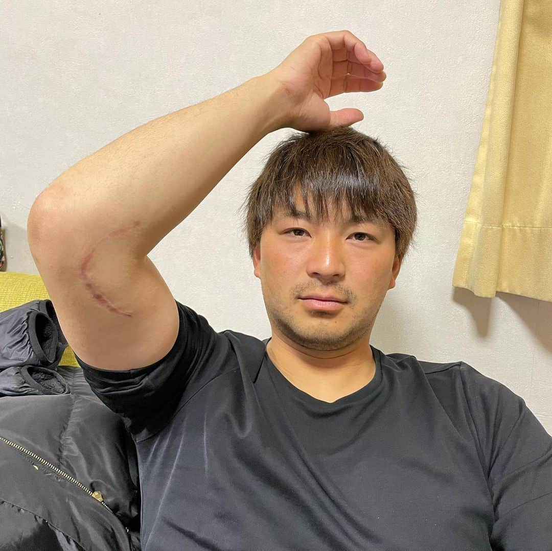 田島慎二のインスタグラム：「今年も１年間ありがとうございました。 キャンプから怪我をして、 ４月には手術。 チームが難しいシーズンを送るなか、１年間全く力になれずリハビリ生活を送ってきました。 今ではたくさんの人のサポートのおかげでかなり順調に回復していると思います。 傷口もここまできれいになりました😁 来シーズンは今まで以上の自分になることを僕自身期待してトレーニングに励んでいます！ 来年はどんな一年になるかわからないですけど、来年末には今年はいい年だったって言えるように頑張っていきます！ また来年もよろしくお願いします。」