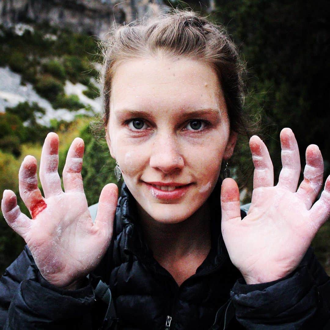 チェルシー・ルーズのインスタグラム：「My skin post send of my first 5.14 (which happened on my 3rd try).   It’s fun to go back through photos and journal entries and reminisce. Reading what made me motivated back then is really fun - especially to fully embrace how much it has changed.   My intention for this year is continue to find that child-like stoke for the rock and embrace the playfulness of our sport. It’s often so easy to take it too seriously - training for this and that - and simply forgetting the ✨joy✨   I suppose going through some injuries/surgeries over the years has helped me realize what a treat climbing is. And if it’s not fun, well, it’s just not worth doing.   I hope to spread the child-like stoke, passion and playfulness that our sport offers to all of my clients that I’m fortunate to work with 🧡  Ps. How old do you think I am in this photo?!」