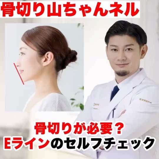 東京美容外科公式のインスタグラム：「骨切り山ちゃんこと東京美容外科の山本先生が解説するEラインのセルフチェック👨‍⚕️  . . . 📞お問い合わせはこちら💁🏼‍♀️ 詳しくはプロフィールのURLから公式サイトへ. ▼フリーダイヤル 0120-658-958 （コールセンター受付時間：9：00～21：00） ▼LINE予約 @ tkc110 ========================= #東京美容外科#美容整形#整形#美活#美容#美容外科#骨切り山ちゃん#他院修正#鼻#輪郭形成#鼻中隔延長#オープン法#エイジング#美白#美肌#鼻#韓国#名古屋#オンライン#ogs＃骨切り」