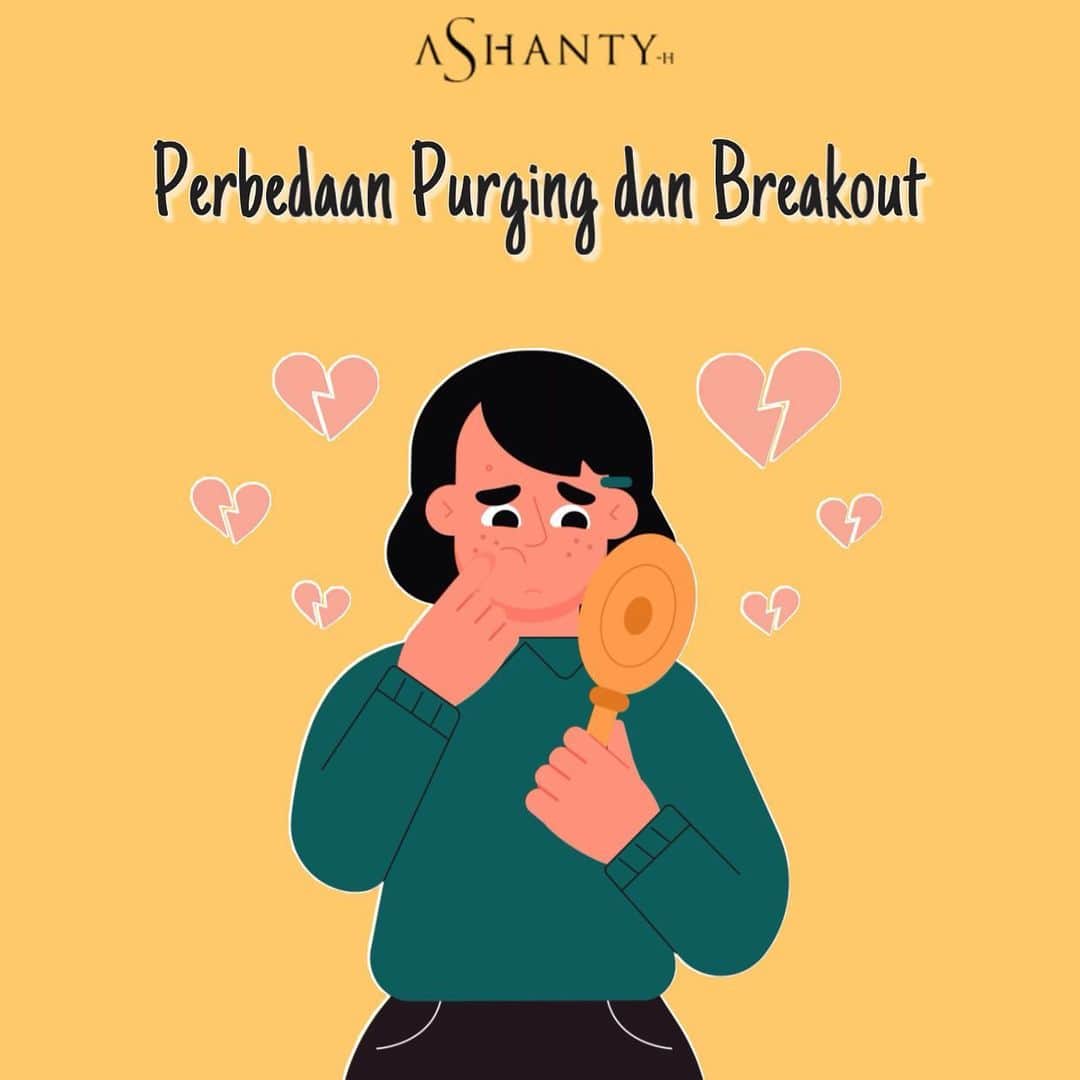 ASHANTY BEAUTY CREAM OFFICIALのインスタグラム：「Hi ladies, masih banyak banget nih yang bingung apasih perbedaan purging dan breakout ? Jadi Perbedaan purging dan breakout terletak pada area munculnya jerawat.  Jerawat saat purging biasanya akan muncul di area kulit yang biasa ditumbuhi jerawat. Sedangkan, jerawat breakout dapat muncul di area kulit mana saja, bahkan pada seluruh wajah.  _________________________________ Informasi dan pemesanan : WA: 085781140354 WA: 087778489900 WA: 081287388885 WA: 081293823950 FAST RESPONS CLICK LINK yang ada di Bio IG @ashantyid  _________________________________ #creamwajag #beauty #cosmetics #brandlocal #skincare #skincarelocal #thehermansyah #beautyvlogger #beauty #kosmetikmahal #ashantyid #keluargaasix #ashantyhermansyah #mua」