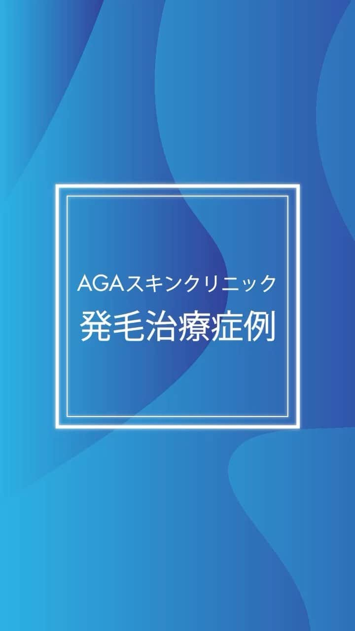 【公式】AGAスキンクリニックのインスタグラム